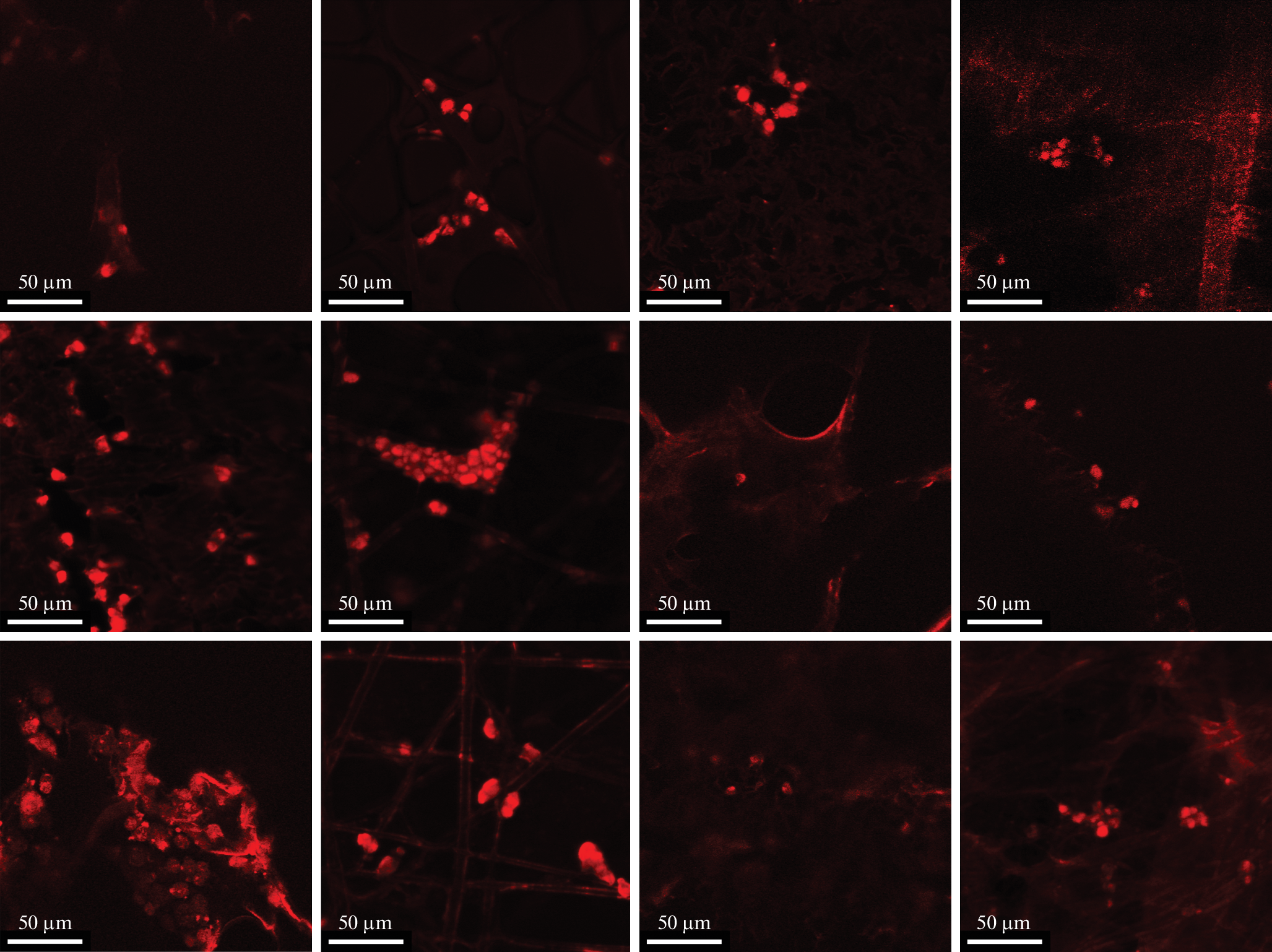 Influence of the Morphological Characteristics and Filling of Polylactide Matrices on the Proliferation of HEK293T Cells