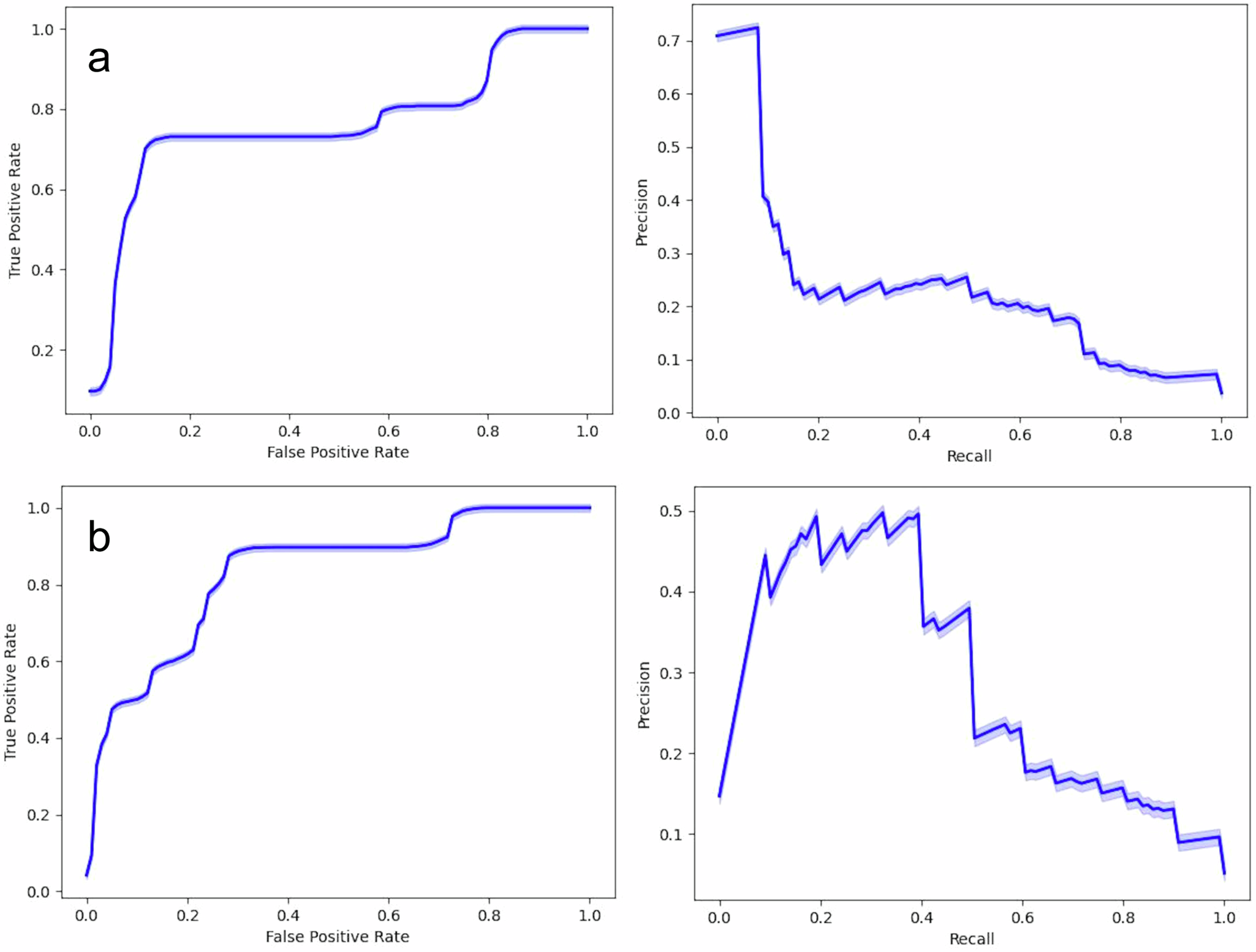 Multimodal fusion learning for long QT syndrome pathogenic genotypes in a racially diverse population