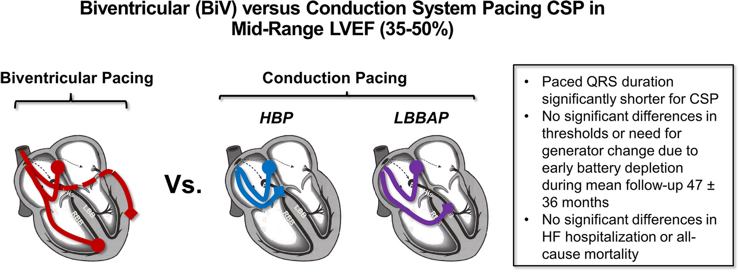 Clinical outcomes of conduction system pacing compared to biventricular pacing in patients with mid-range ejection fraction