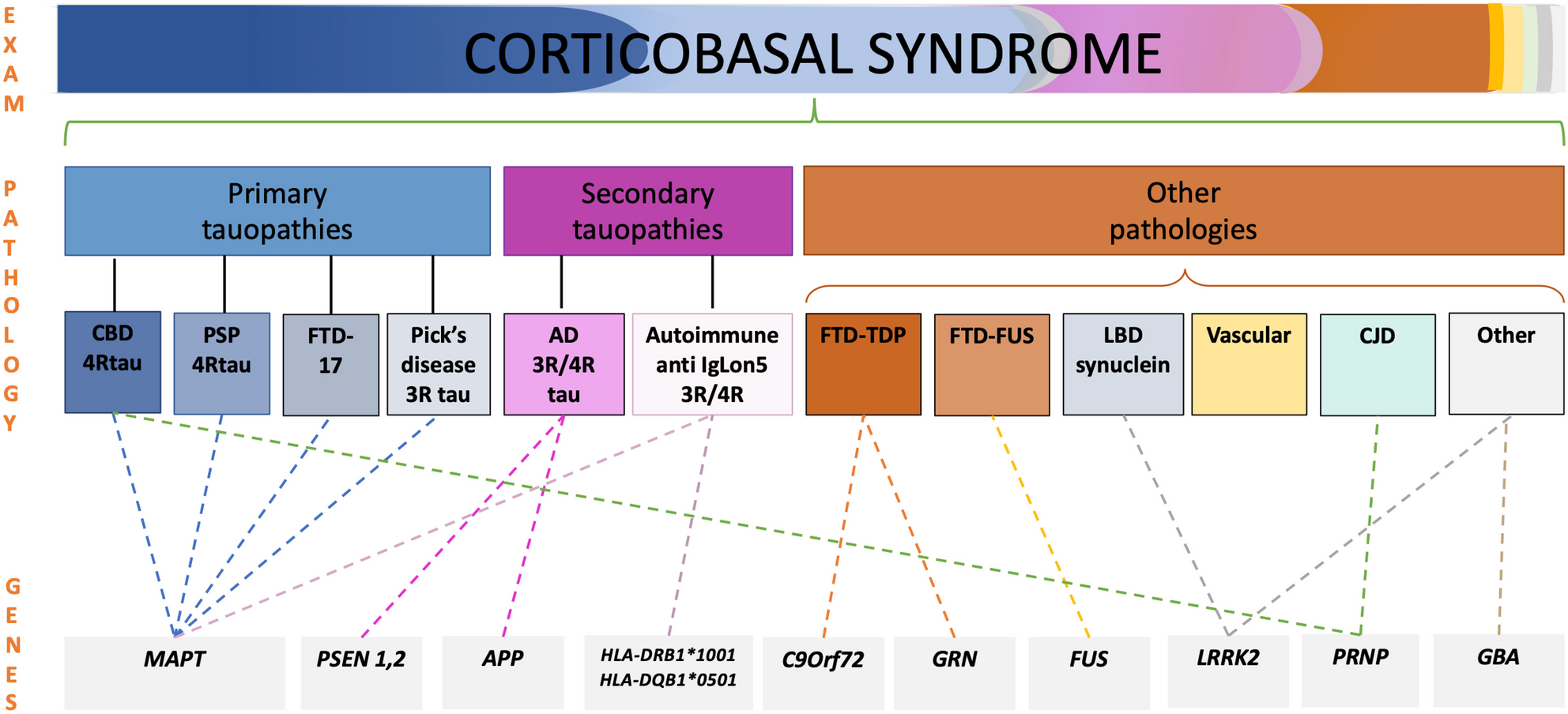 Diagnosis and Management of Progressive Corticobasal Syndrome