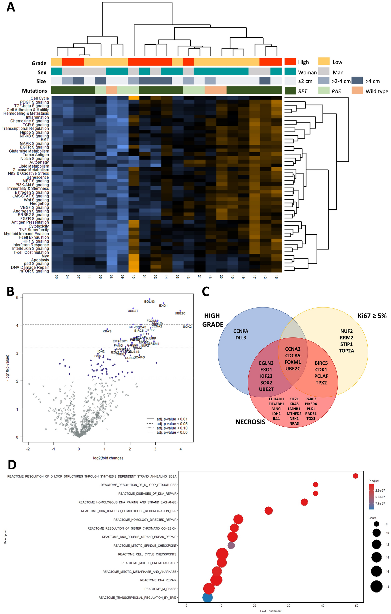 Transcriptomic Differences in Medullary Thyroid Carcinoma According to Grade