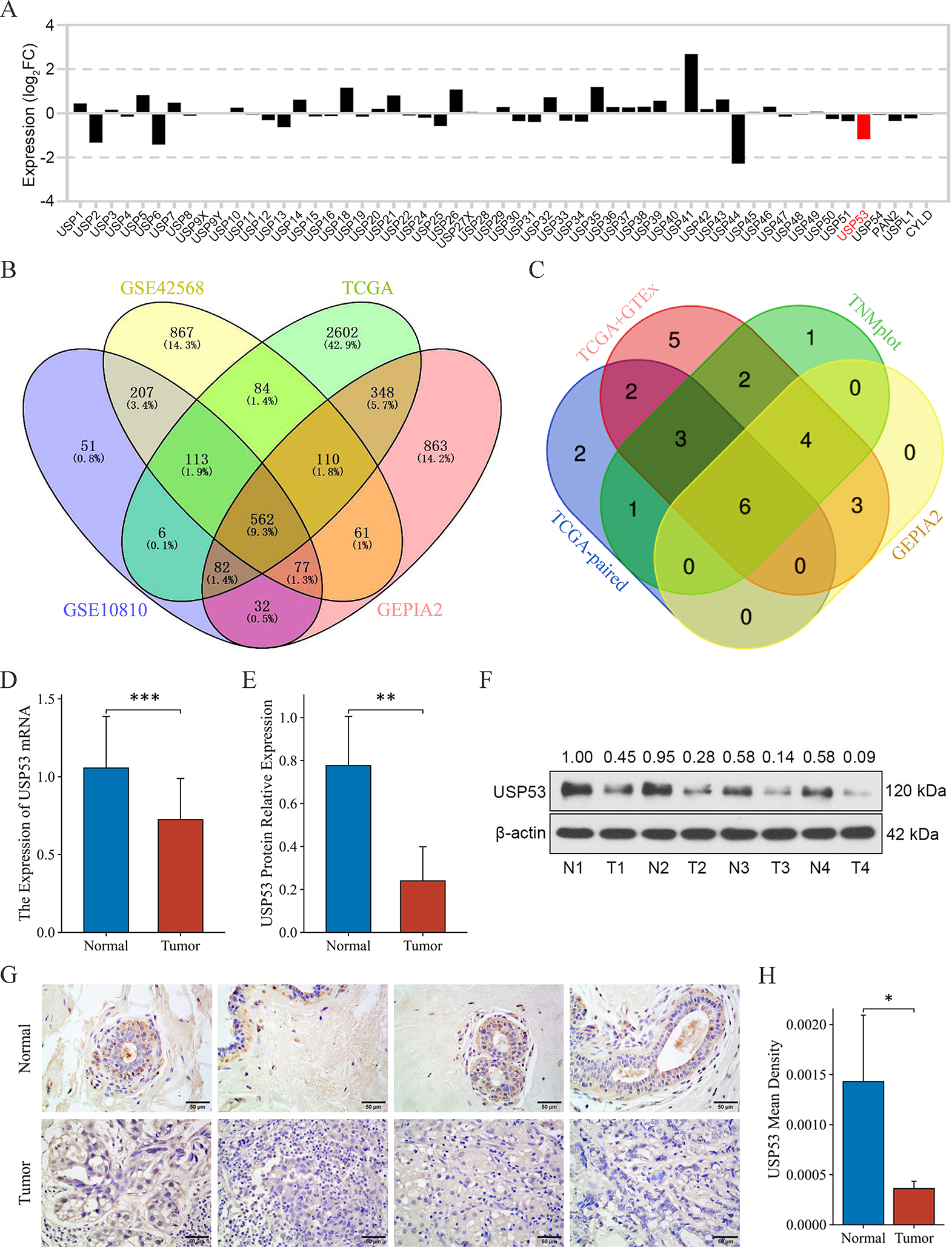 USP53 Affects the Proliferation and Apoptosis of Breast Cancer Cells by Regulating the Ubiquitination Level of ZMYND11