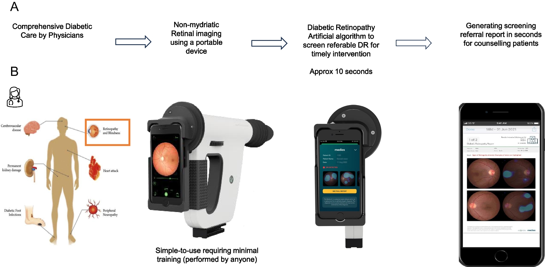 Enhancing comprehensive diabetic care: A smartphone fundus camera with an offline AI-powered diabetic retinopathy screening solution for physicians