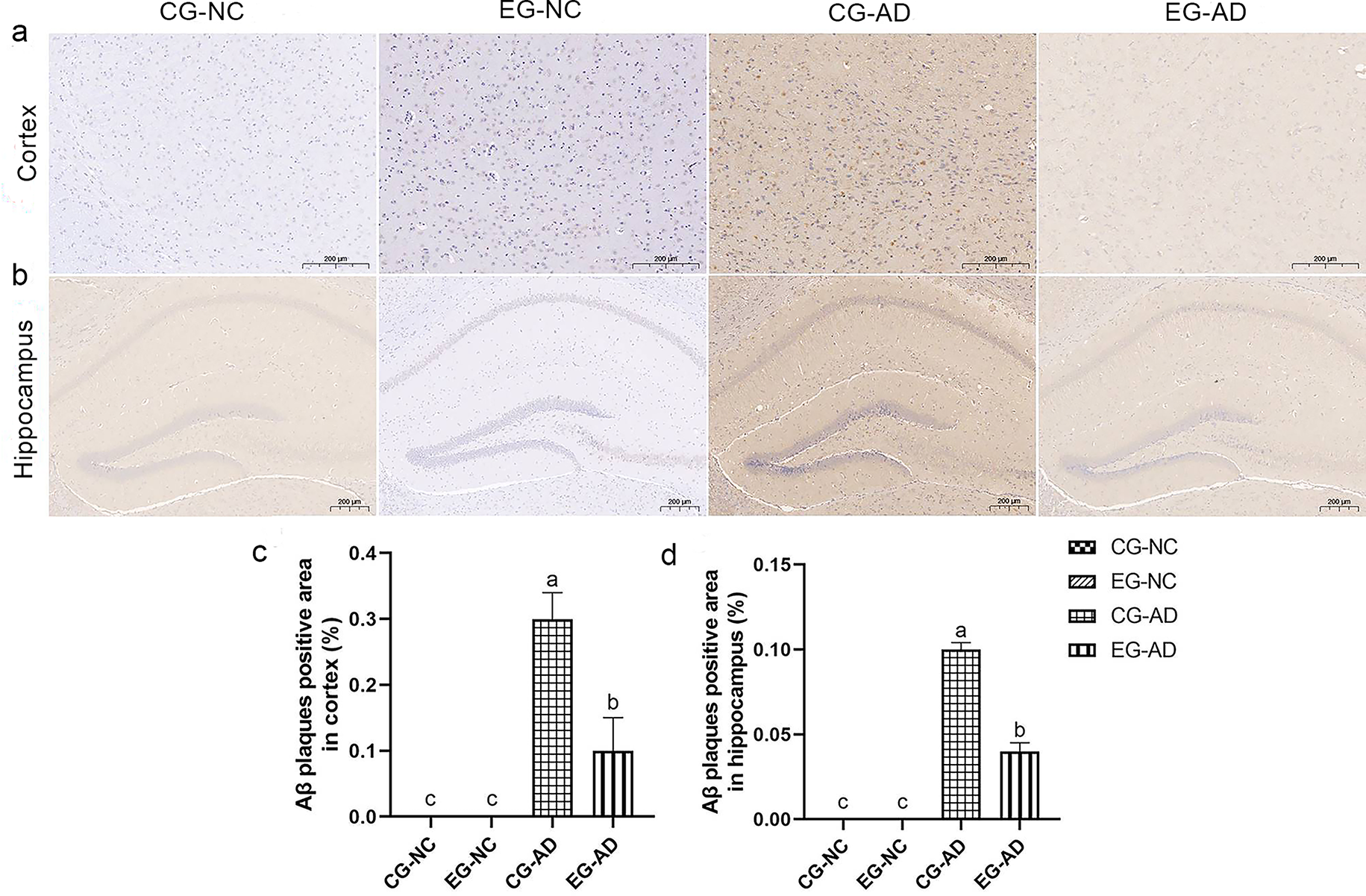 NMN Synbiotics: A Multifaceted Therapeutic Approach for Alzheimer’s Disease