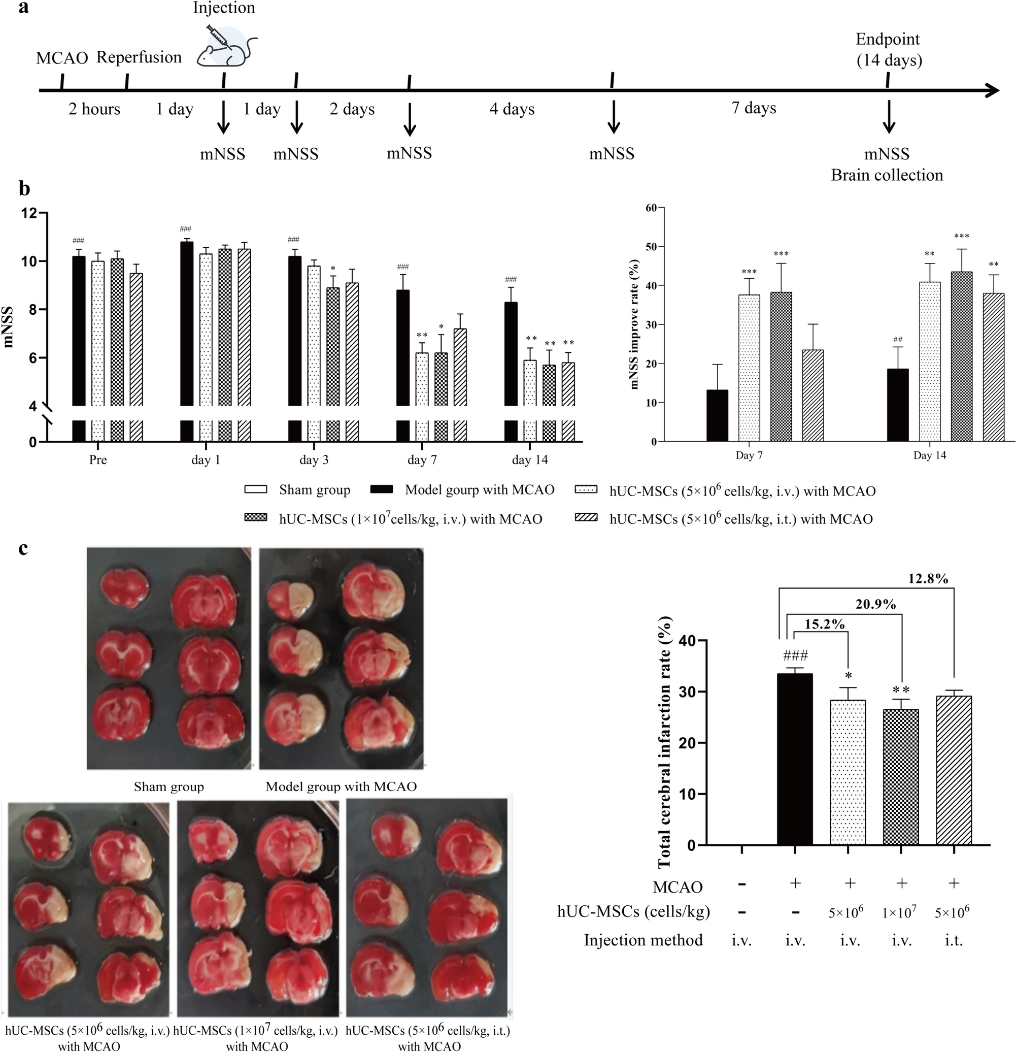 Neuroprotection of Human Umbilical Cord-Derived Mesenchymal Stem Cells (hUC-MSCs) in Alleviating Ischemic Stroke-Induced Brain Injury by Regulating Inflammation and Oxidative Stress