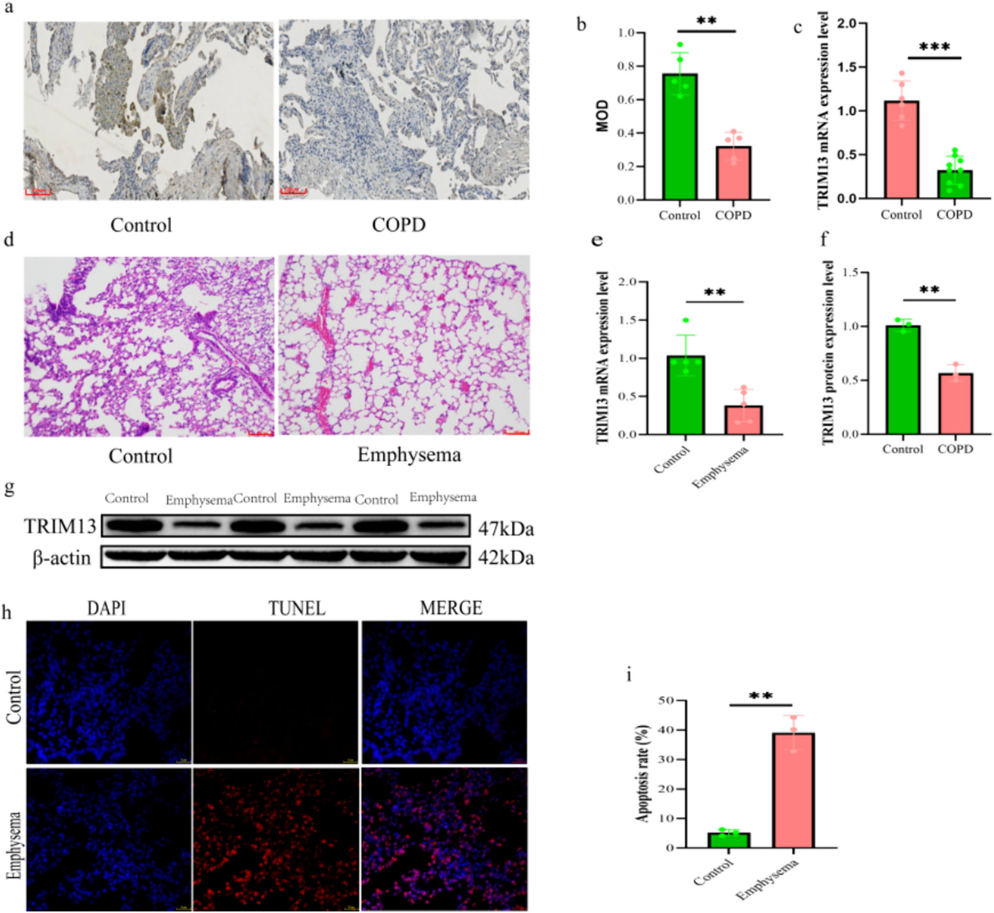 TRIM13 Reduces Damage to Alveolar Epithelial Cells in COPD by Inhibiting Endoplasmic Reticulum Stress-Induced ER-Phagy