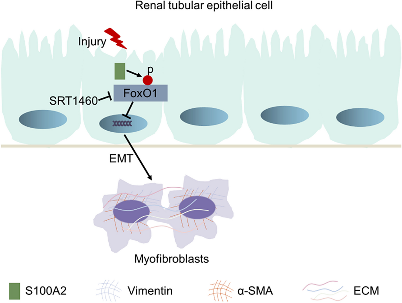 S100A2 activation promotes interstitial fibrosis in kidneys by FoxO1-mediated epithelial-mesenchymal transition