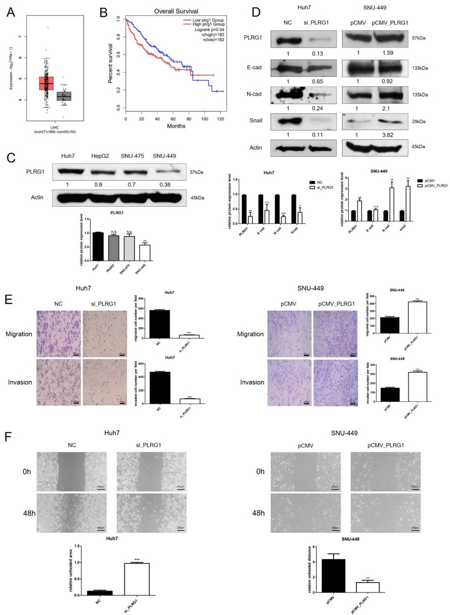 YBX1 promotes epithelial-mesenchymal transition in hepatocellular carcinoma via transcriptional regulation of PLRG1