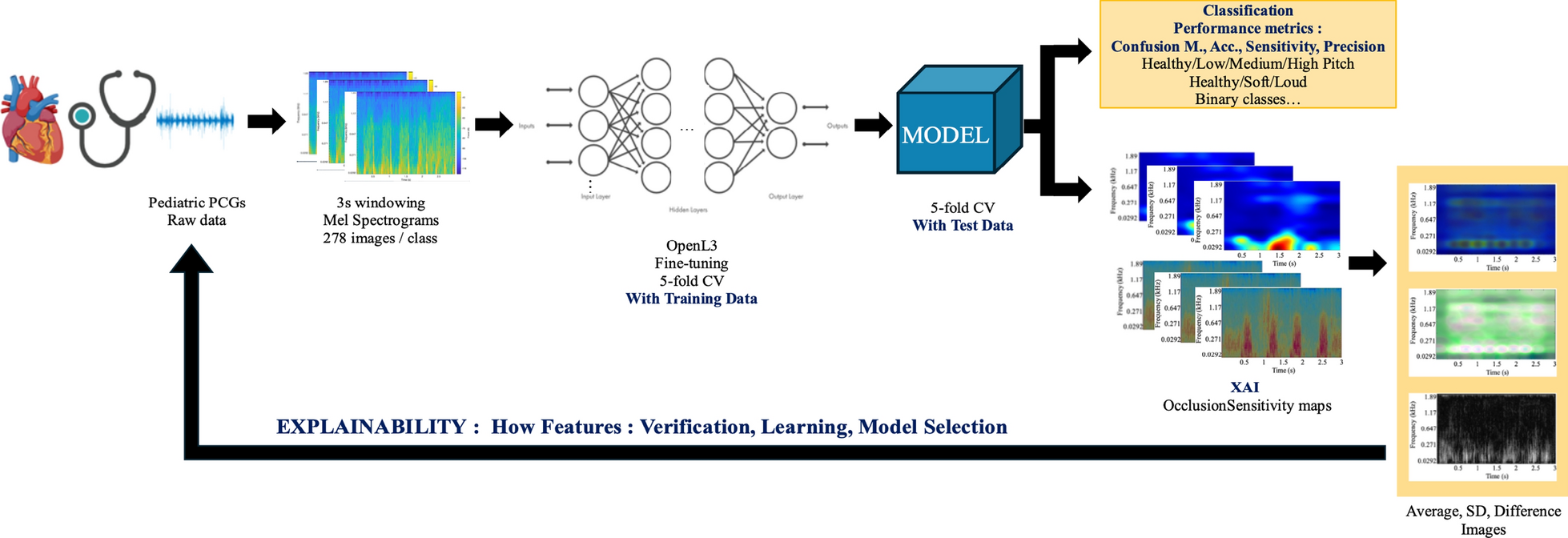 Rapid detection and interpretation of heart murmurs using phonocardiograms, transfer learning and explainable artificial intelligence