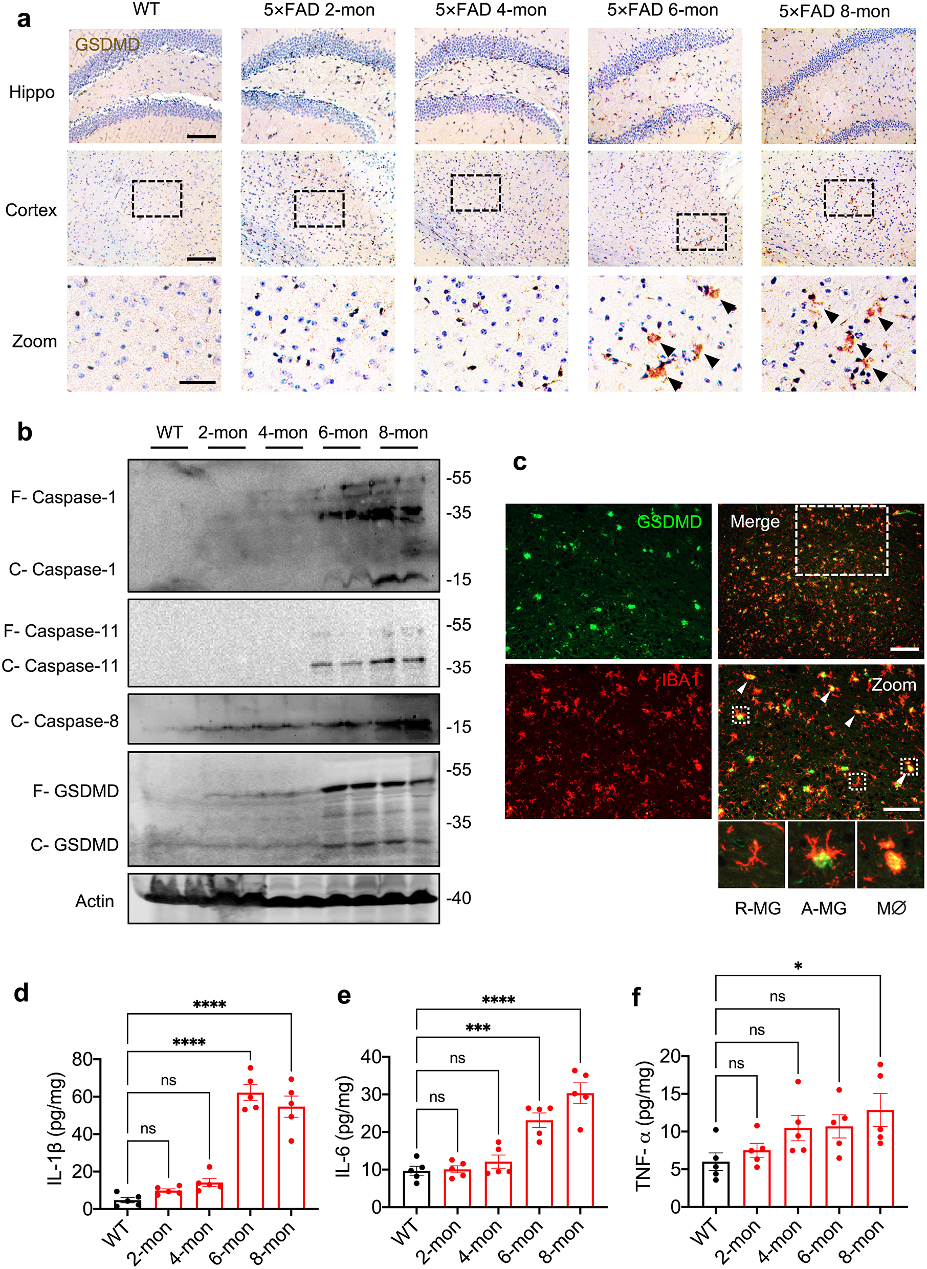 Myeloid gasdermin D drives early-stage T cell immunity and peripheral inflammation in a mouse model of Alzheimer’s disease