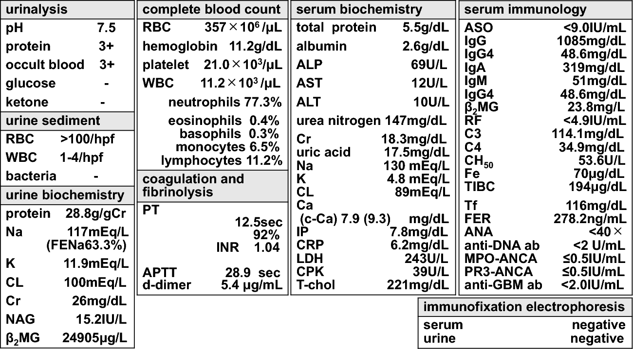 Macroscopic hematuria-associated severe acute kidney injury triggered by kidney stone formation in a patient with thin basement membrane and no history of microscopic hematuria