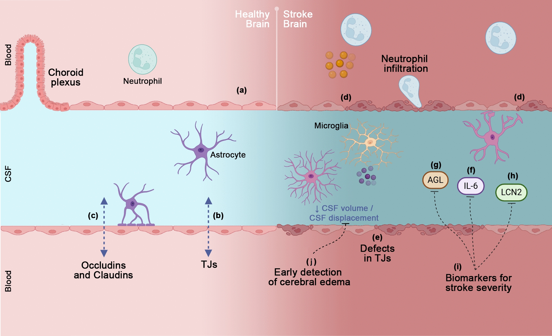 The Blood-Cerebrospinal Fluid Barrier Dysfunction in Brain Disorders and Stroke: Why, How, What For?