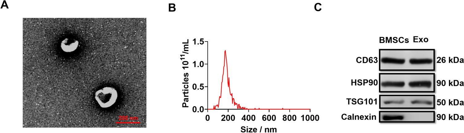 Exosomal GDNF from Bone Marrow Mesenchymal Stem Cells Moderates Neuropathic Pain in a Rat Model of Chronic Constriction Injury