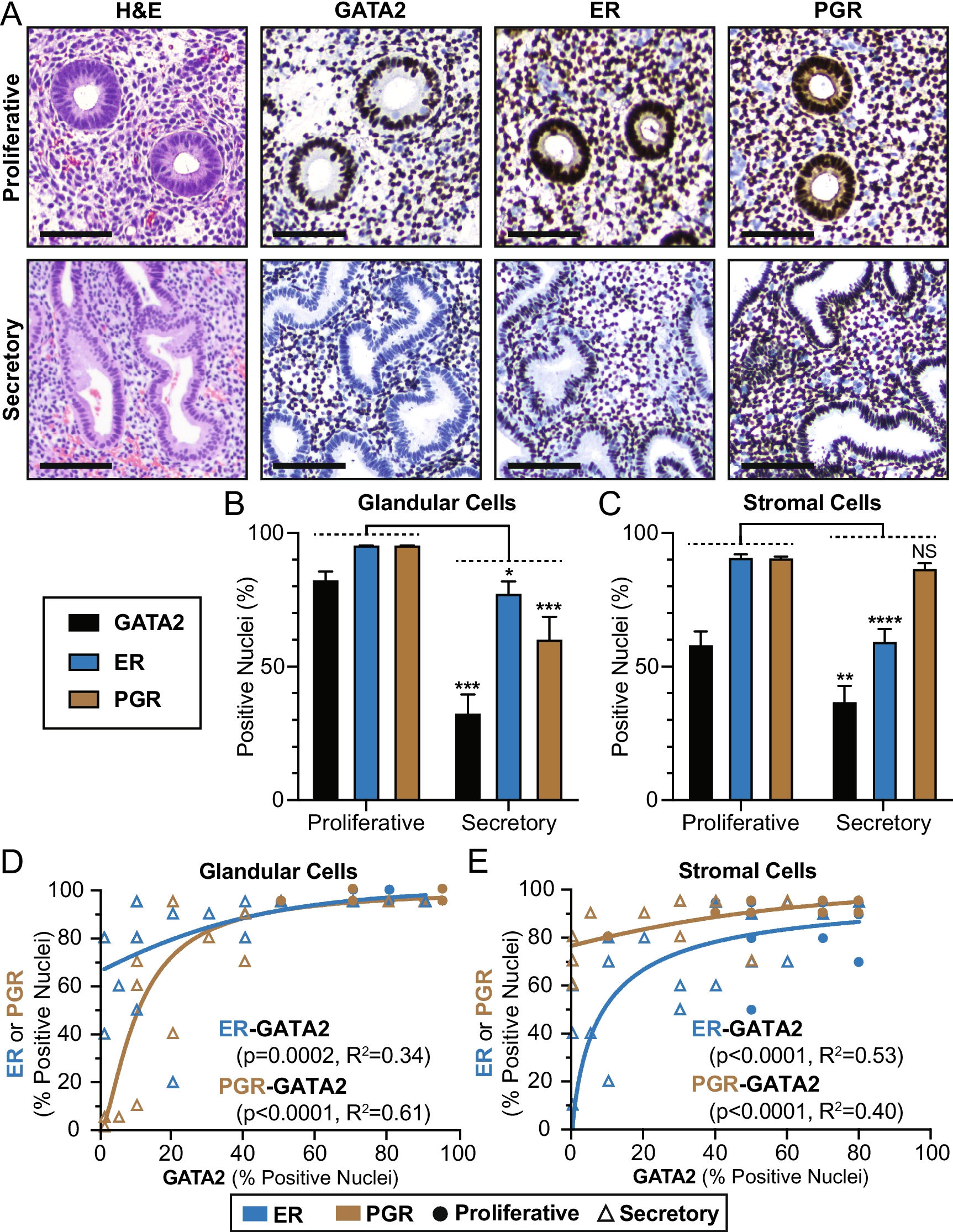 Immunohistochemical Analysis of GATA2 Expression in Endometrium and its Relationship with Hormone Receptor Expression in Benign and Premalignant Endometrial Disorders