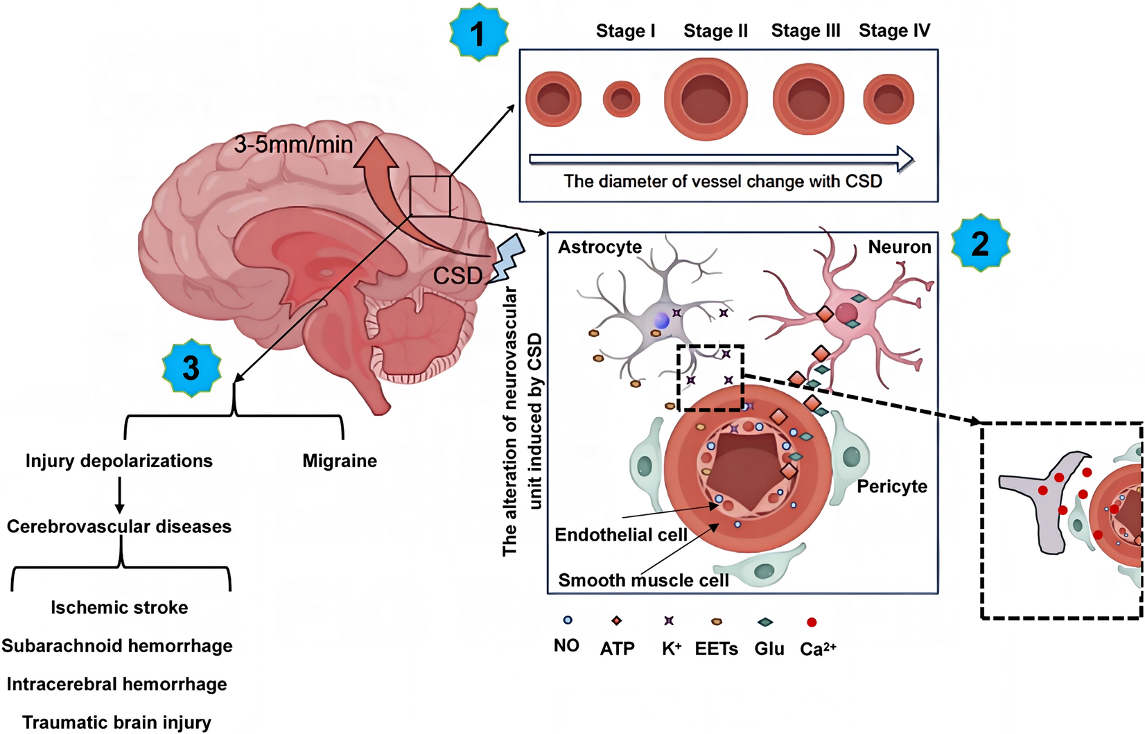 Understanding Headaches Attributed to Cranial and/or Cervical Vascular Disorders: Insights and Challenges for Neurologists