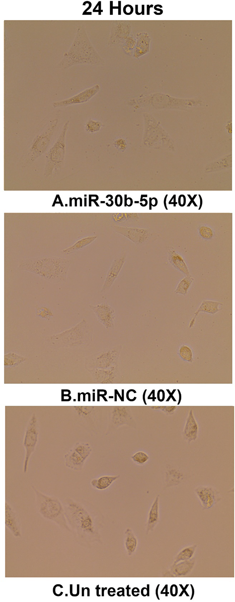 miR-30b-5p Promotes Medulloblastoma Cell Proliferation by Regulating Stem Cell Factors NANOG, BMI1, Tumor Suppressor Gene P53 and the Shh-Gli1 Pathway