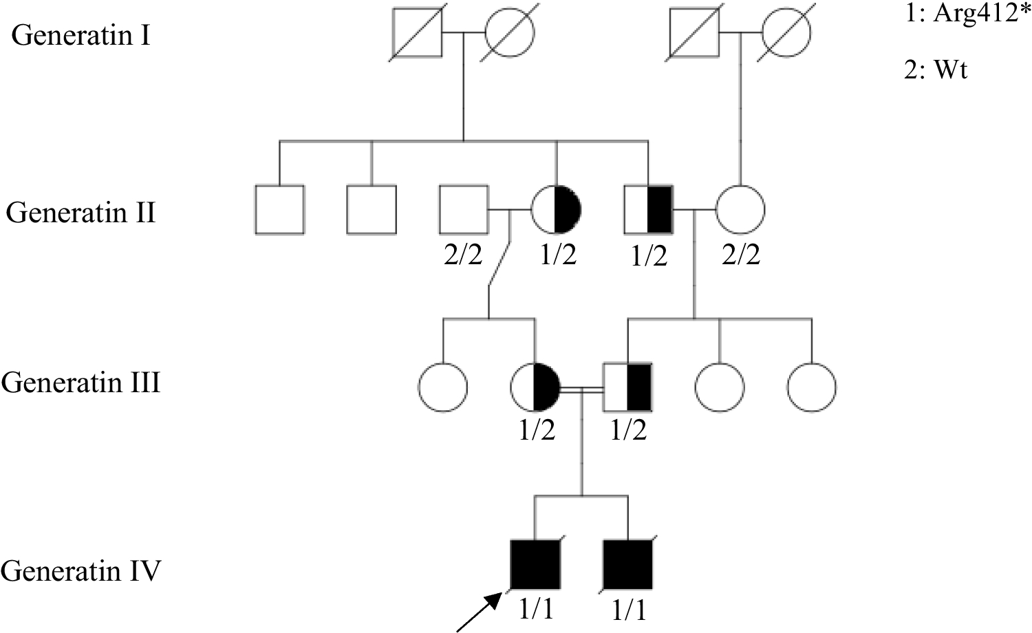 The lethal homozygous variant in the ATP1A2 gene is associated with FARIMPD syndrome phenotypes in newborns