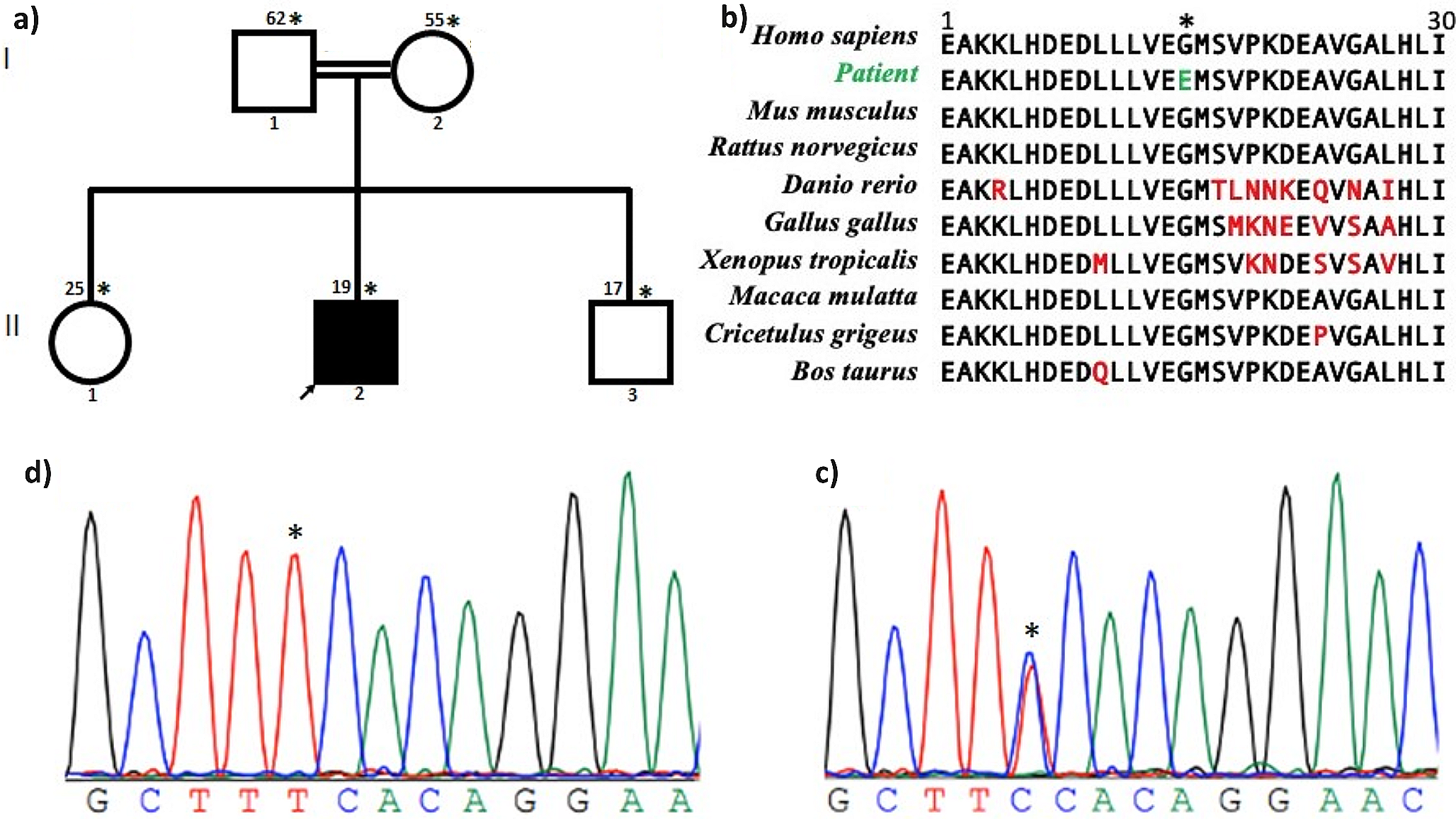 A novel variant in the GNE gene in a Malian patient presenting with distal myopathy