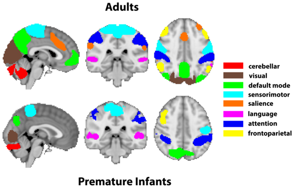 Functional connectivity of the pediatric brain