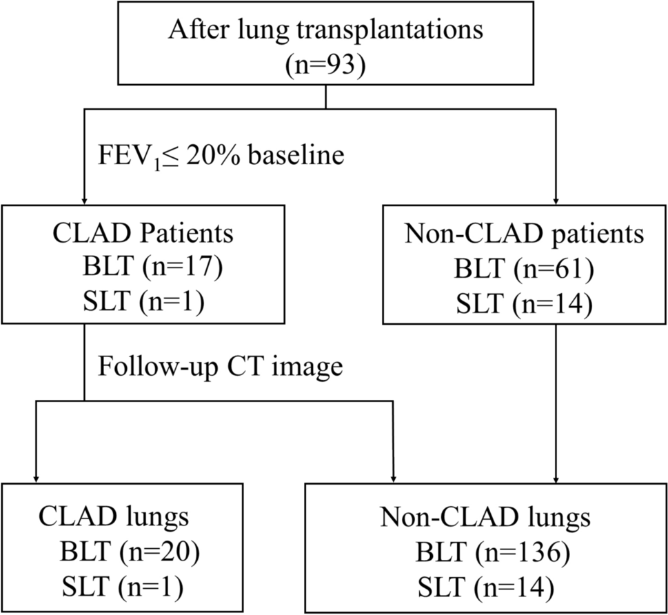 Deep learning-based approach for acquisition time reduction in ventilation SPECT in patients after lung transplantation