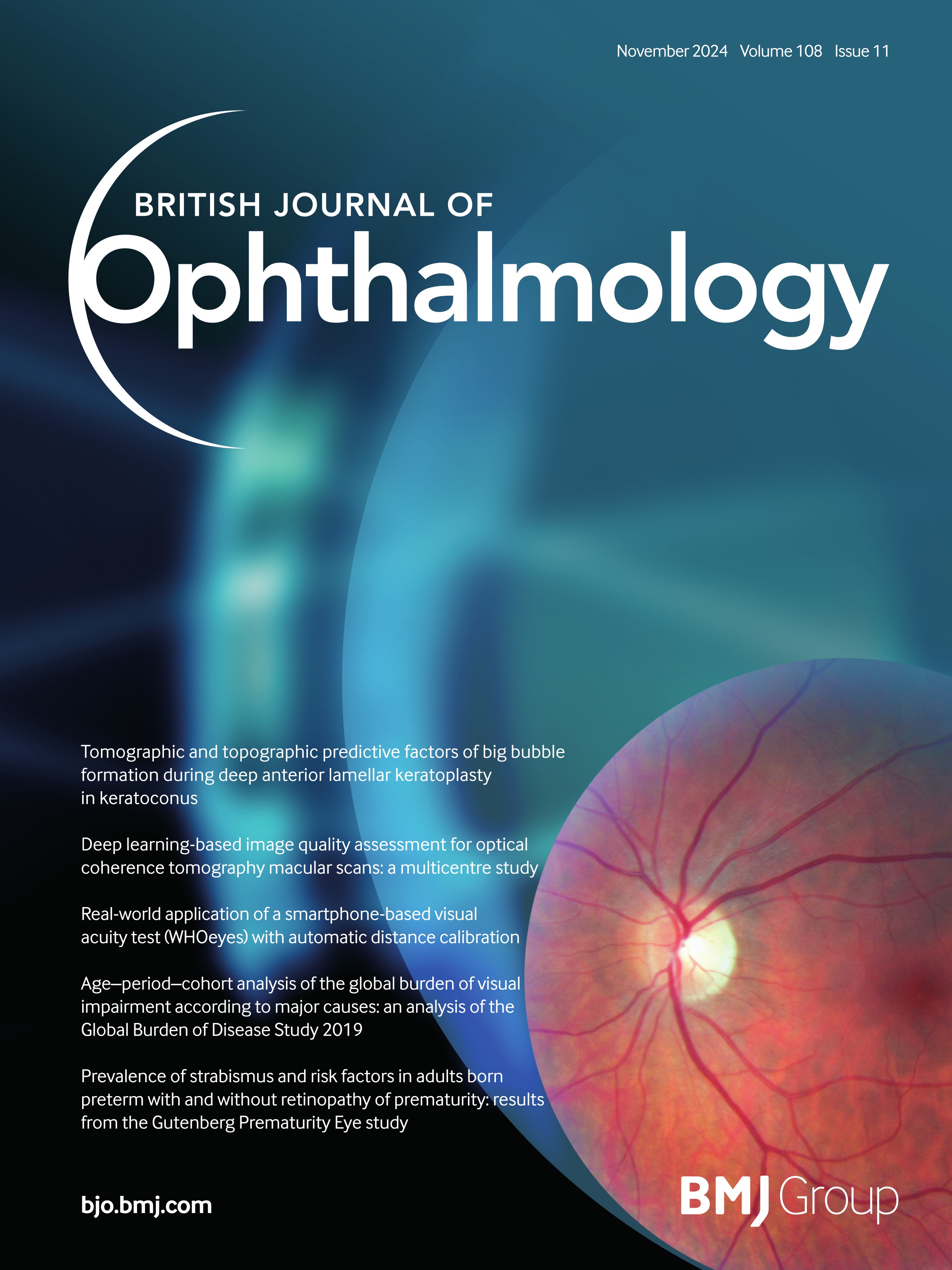 Continuous 24-hour intraocular pressure monitoring in normal Chinese adults using a novel contact lens sensor system