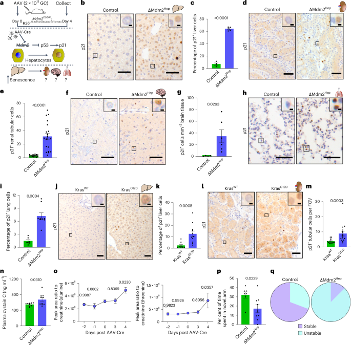 Hepatocellular senescence induces multi-organ senescence and dysfunction via TGFβ