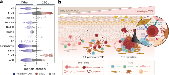 B cells infiltrate cutaneous T cell lymphomas