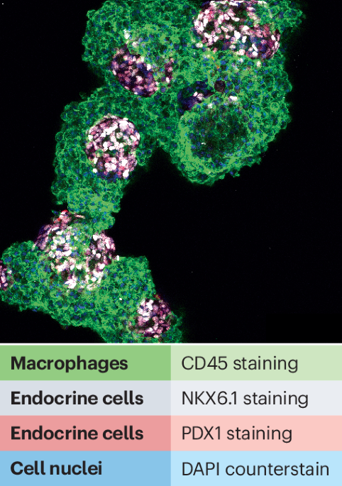 Macrophages support pancreatic development