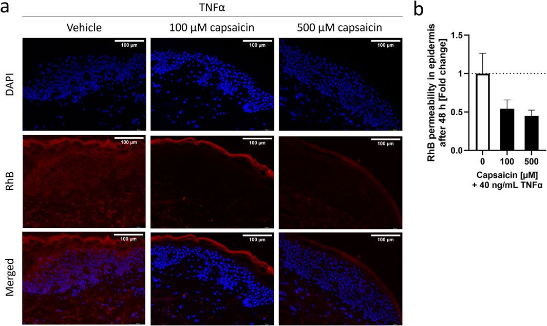 Capsaicin attenuates the effect of inflammatory cytokines in a HaCaT cell model for basal keratinocytes