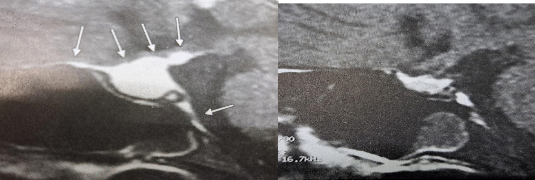 Neurological and Systemic Pitfalls in the Diagnosis of Cluster Headaches: A Case-Based Review