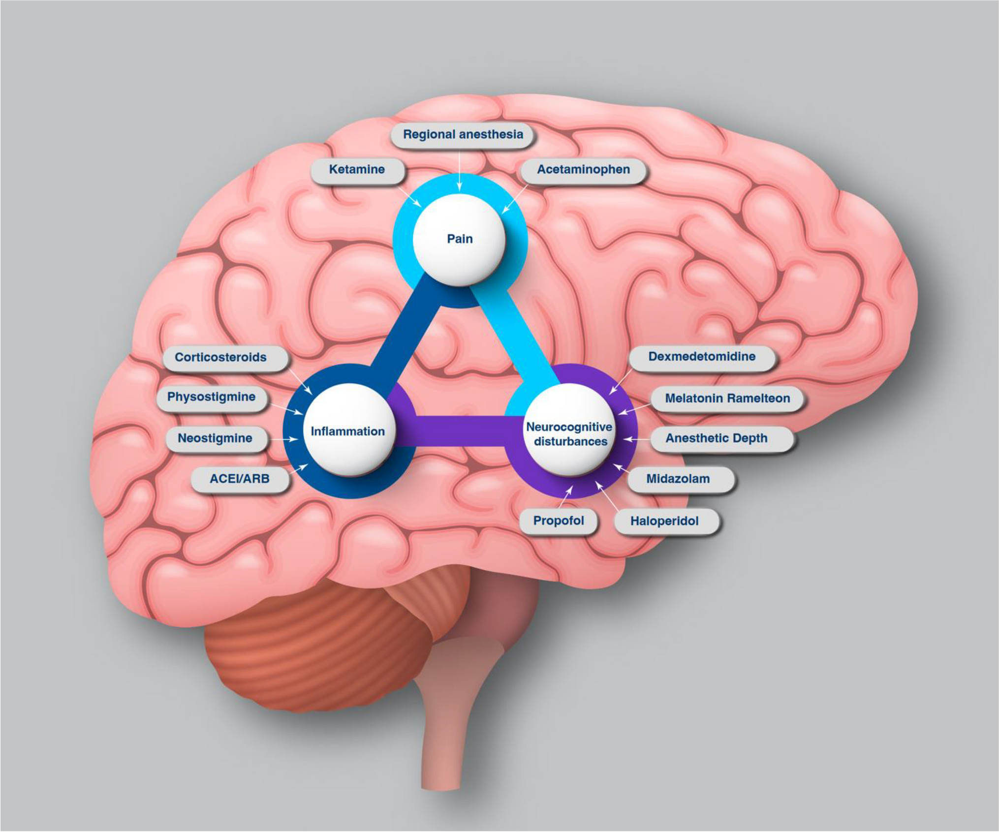 Pharmacological Prevention of Postoperative Delirium in Adults: A Review of Recent Literature