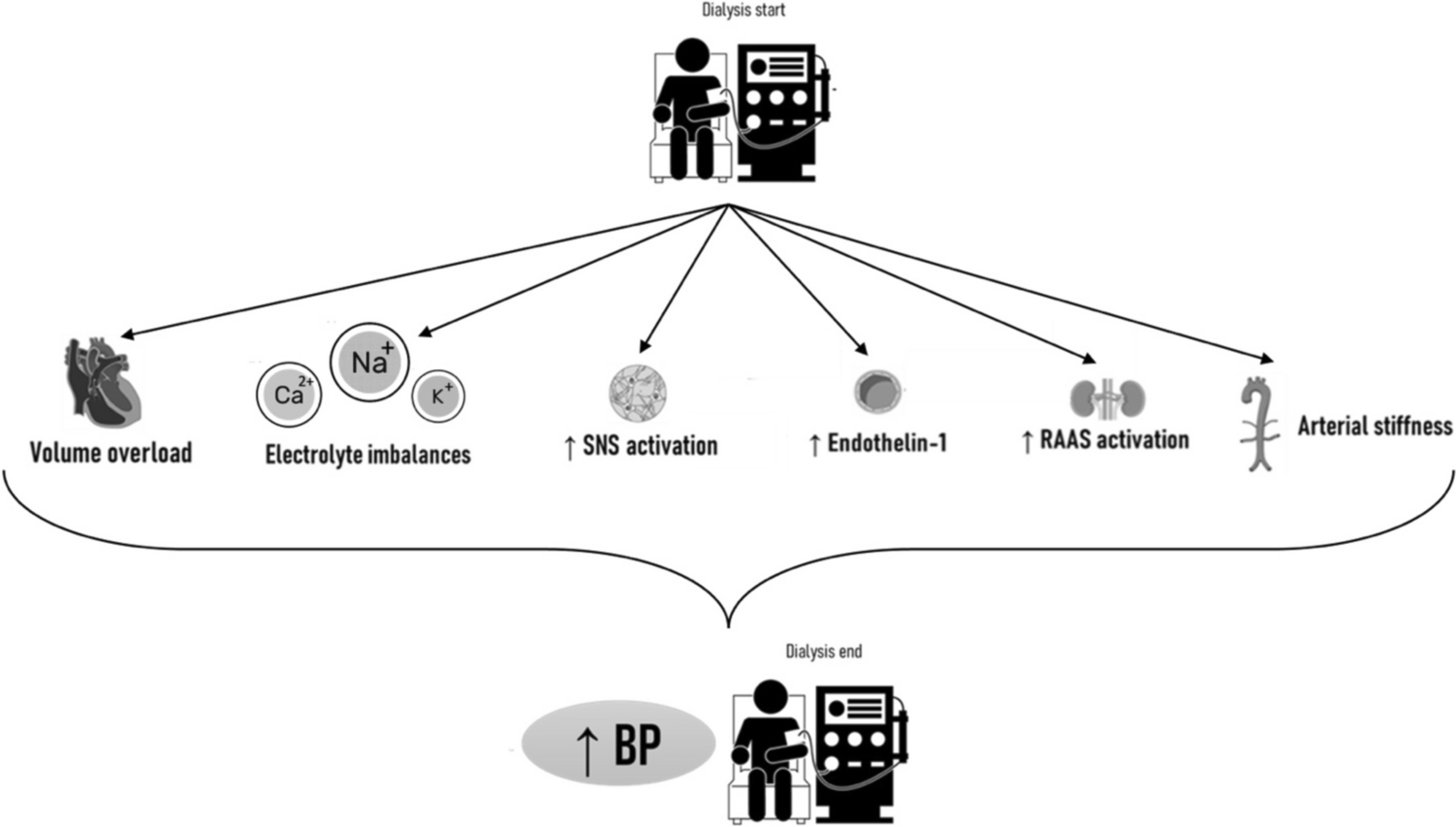 Intradialytic Hypertension in Maintenance Hemodialysis