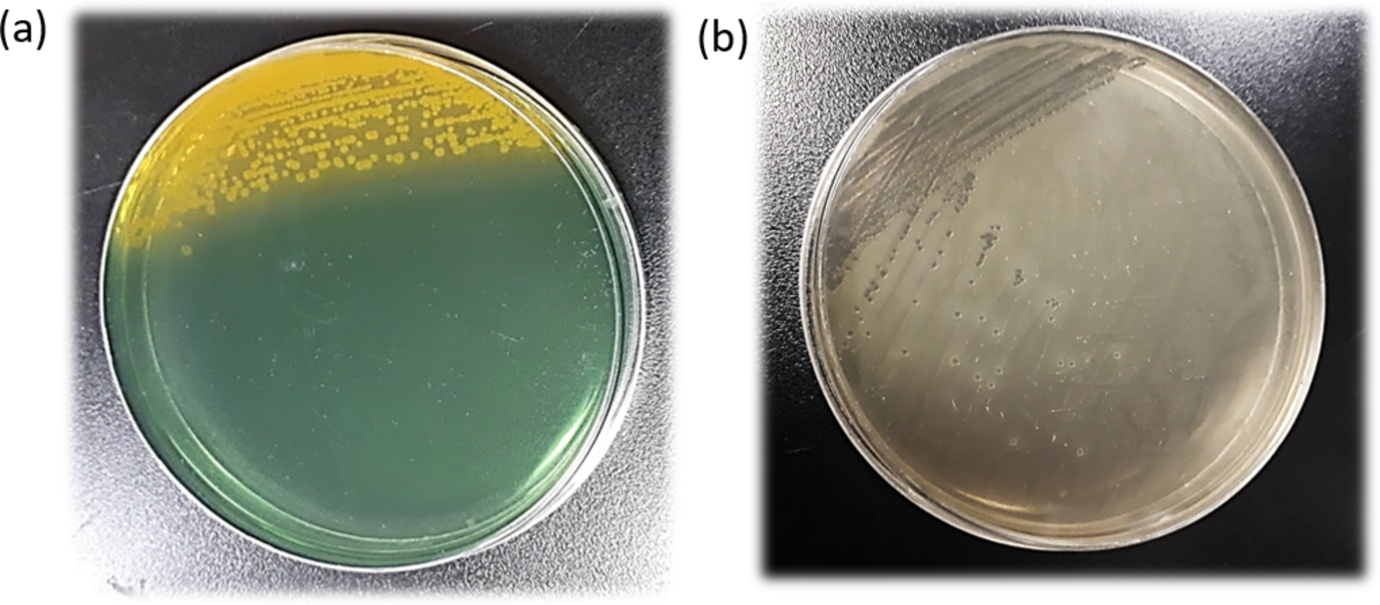 A fatal case of Vibrio cholerae-associated diarrhea and bacteremia in a 30-year-old carrier of beta-thalassemia