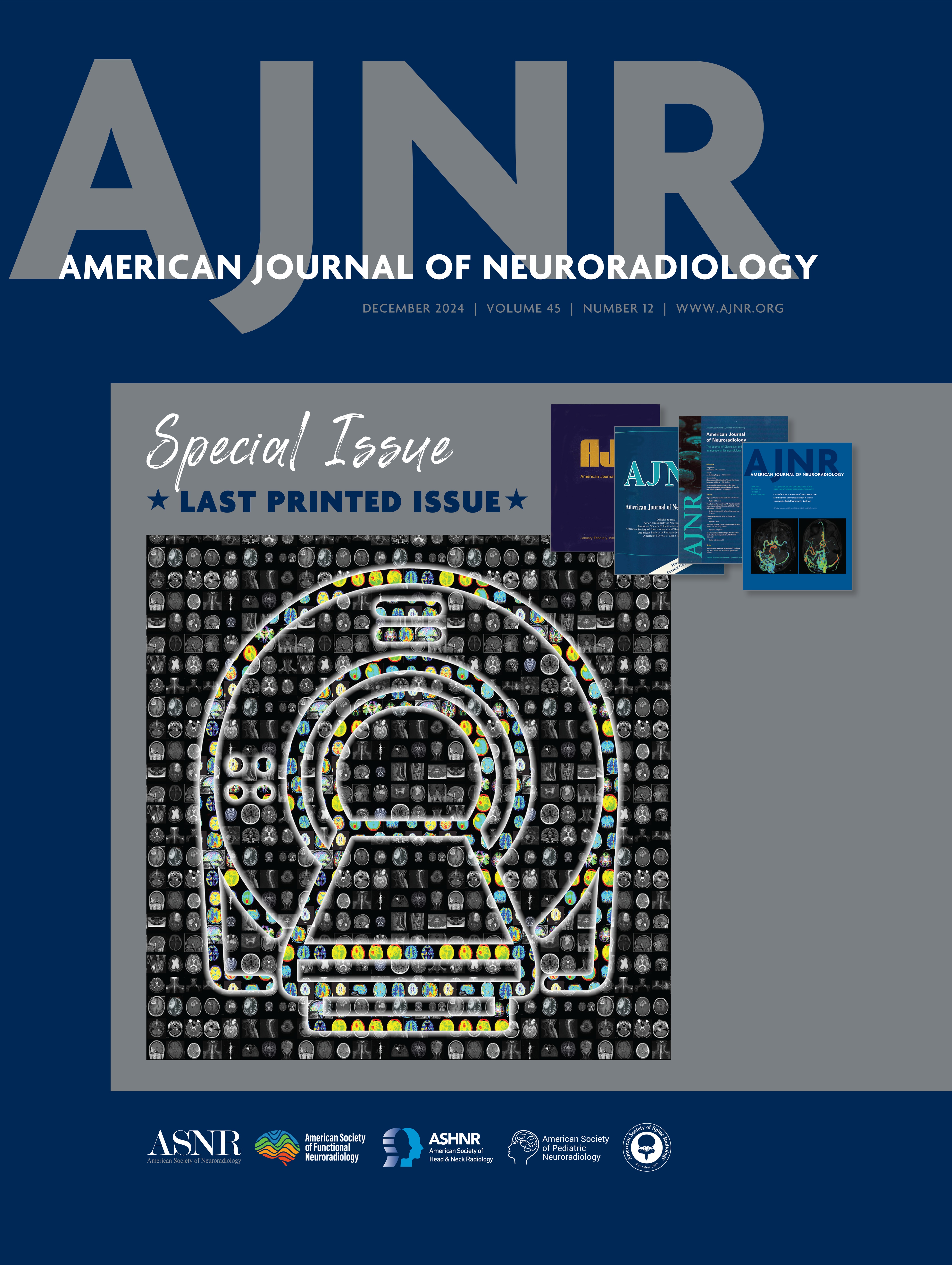 CNS Vasculitis in Autoimmune Disease: MR Imaging Findings and Correlation with Angiography [CLINICAL PRACTICE]