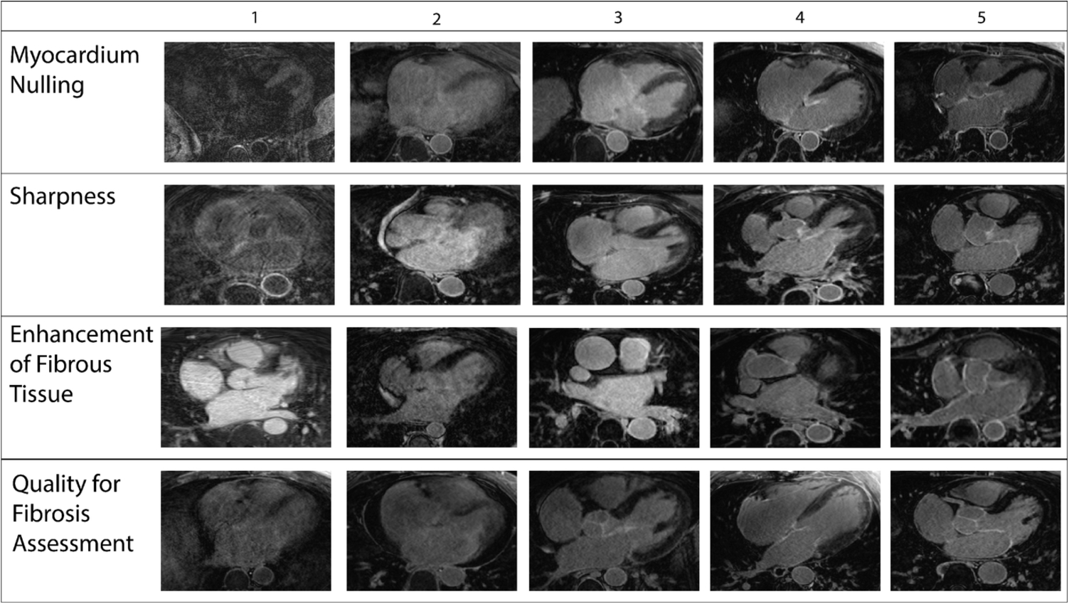 Image quality assessment and automation in late gadolinium-enhanced MRI of the left atrium in atrial fibrillation patients