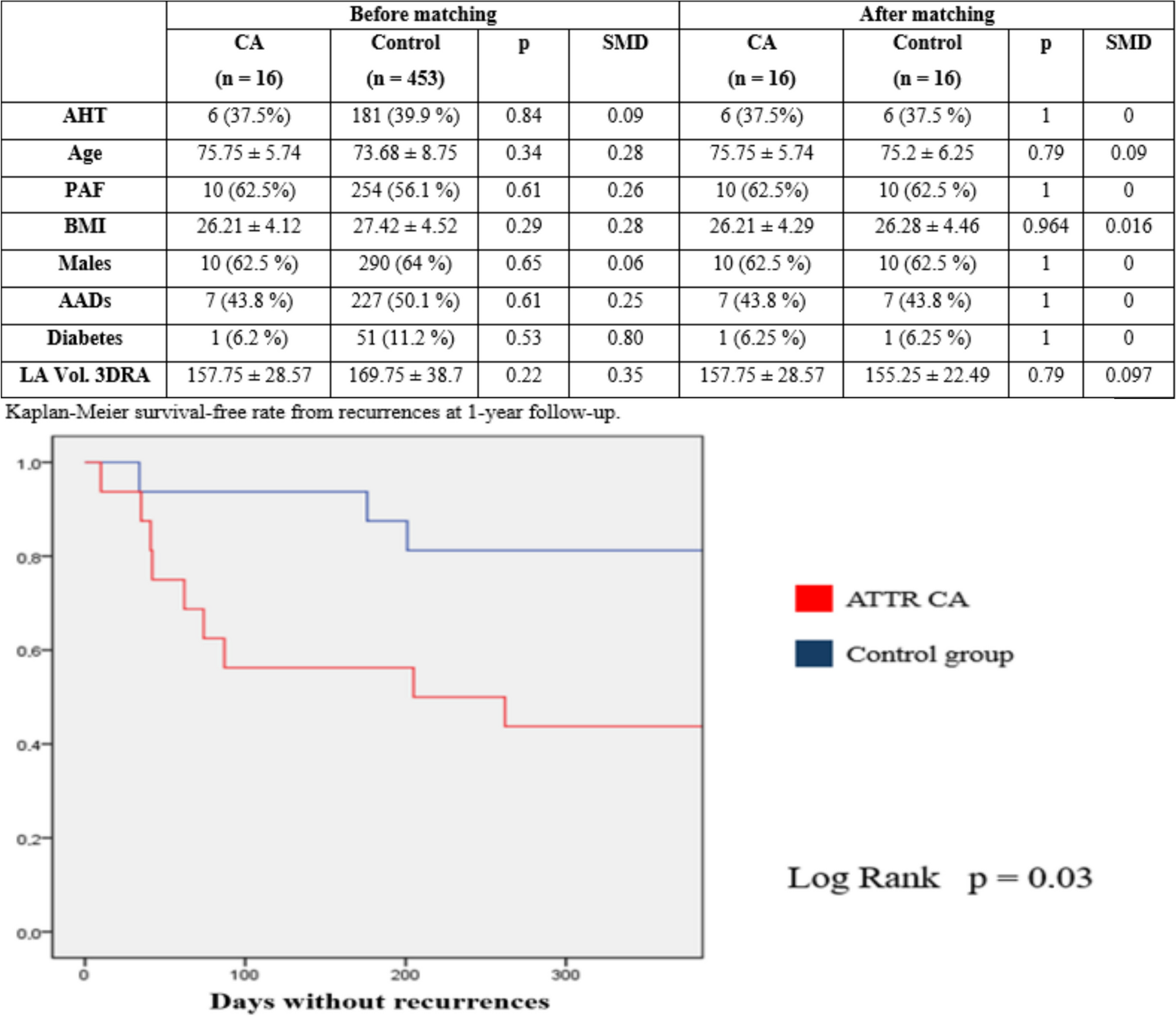 Atrial fibrillation recurrence in patients with transthyretin cardiac amyloidosis undergoing pulmonary veins isolation