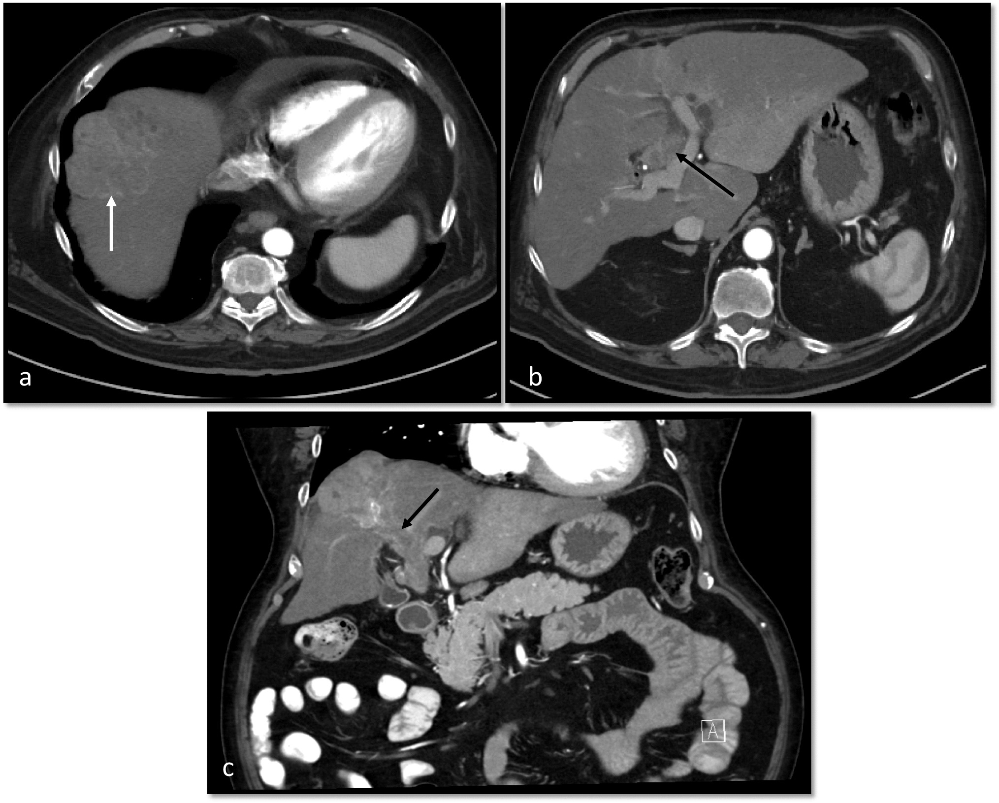 Advanced Imaging of Hepatocellular Carcinoma: A Review of Current and Novel Techniques