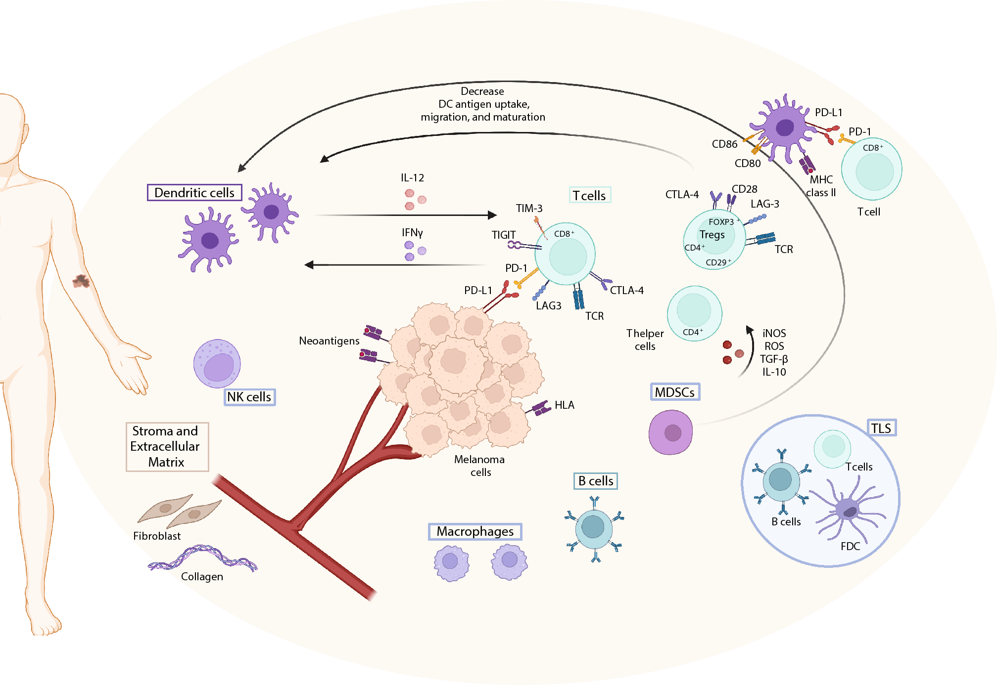 Overcoming Resistance Mechanisms to Melanoma Immunotherapy