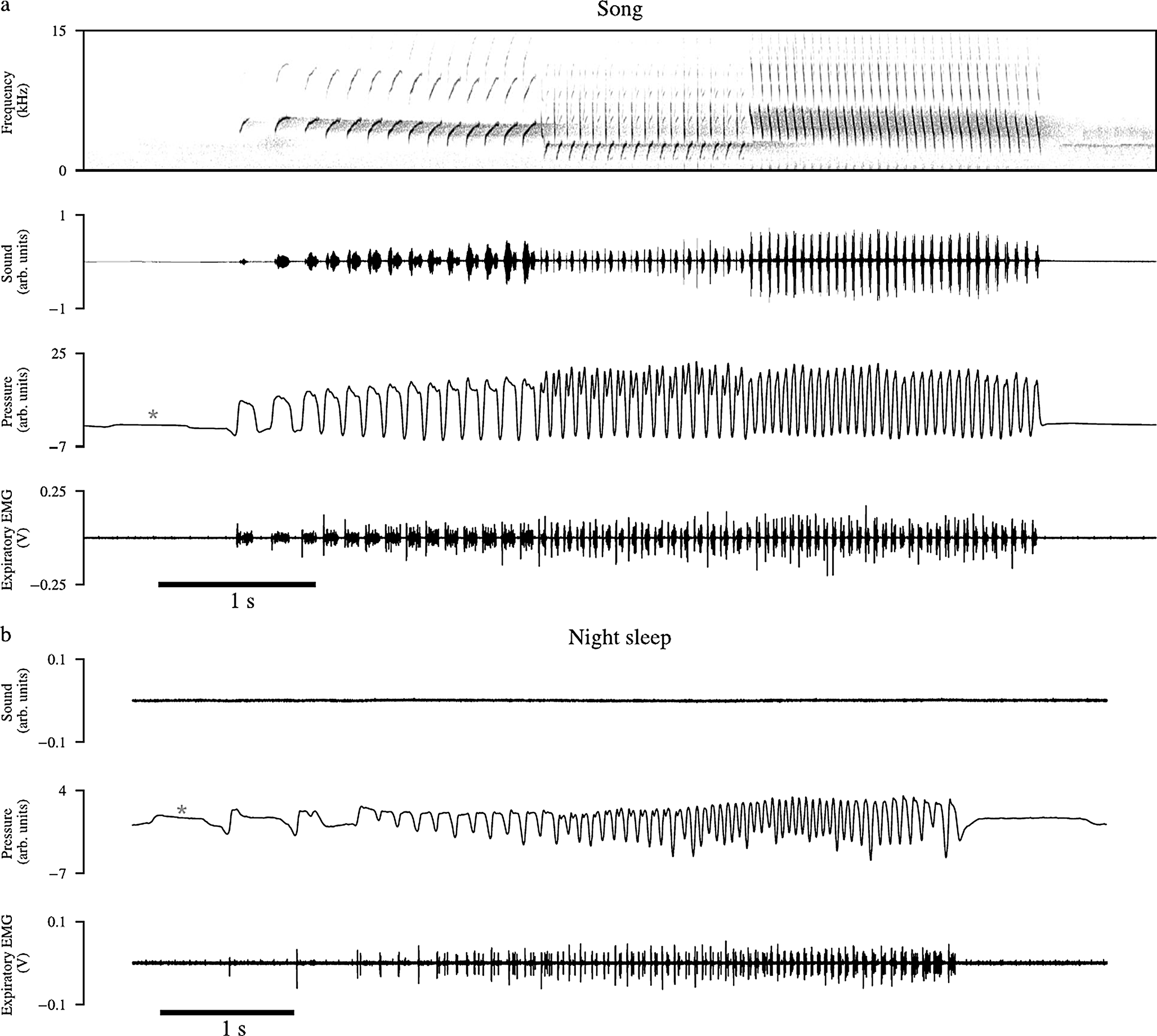 Song-like activation of syringeal and respiratory muscles during sleep in canaries