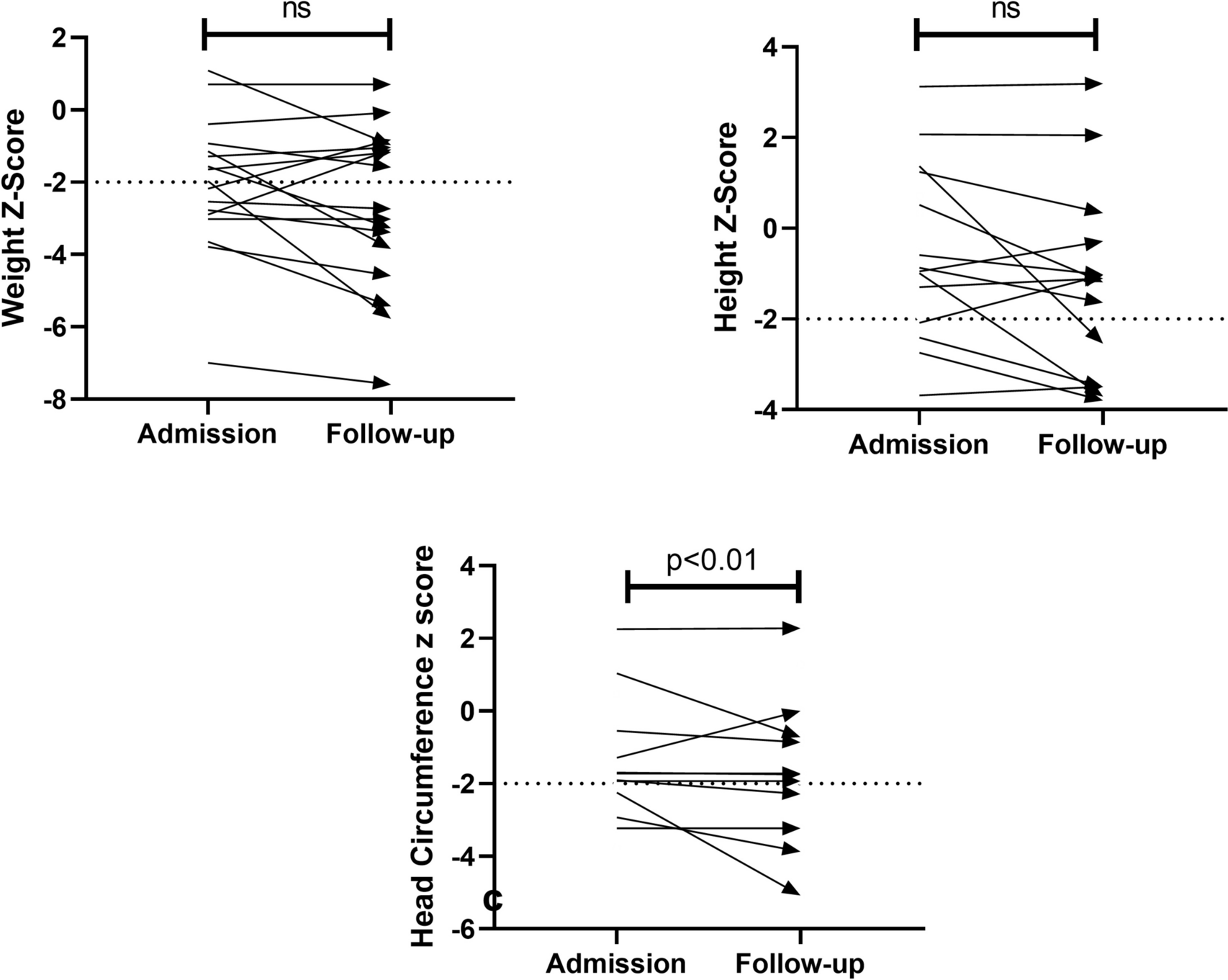 Clinical and genetic characteristics of patients with monocarboxylate transporter-8 deficiency: a multicentre retrospective study