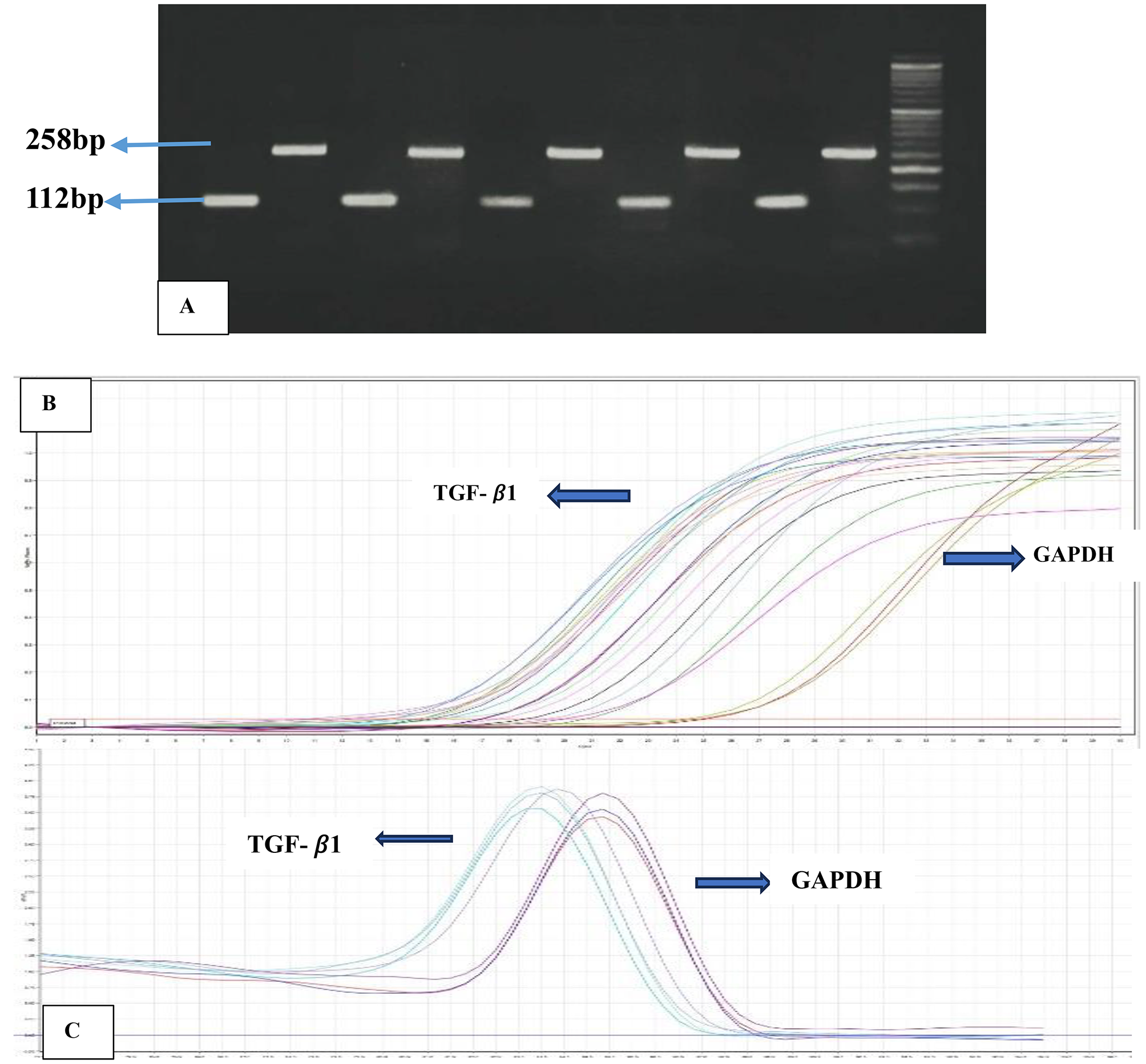 Evaluating the role of active TGF-β1 as inflammatory biomarker in Kashmiri (North-Indian) patients with systemic sclerosis: a case-control study