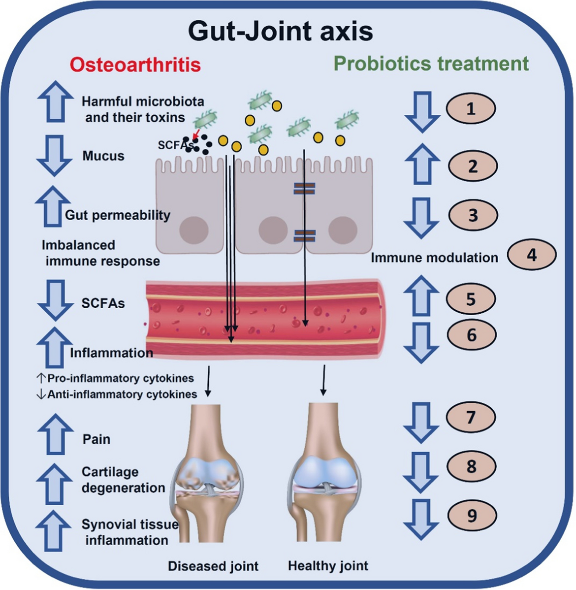 Unveiling the Potential of Probiotics in Osteoarthritis Management