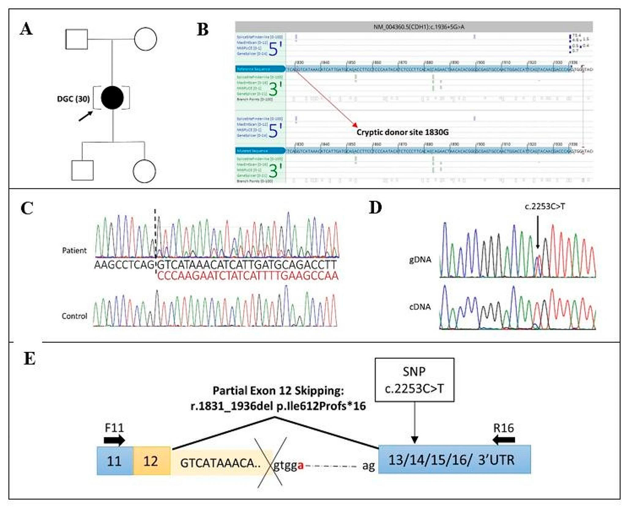 Aberrant transcription caused by an intronic non-canonical CDH1 variant