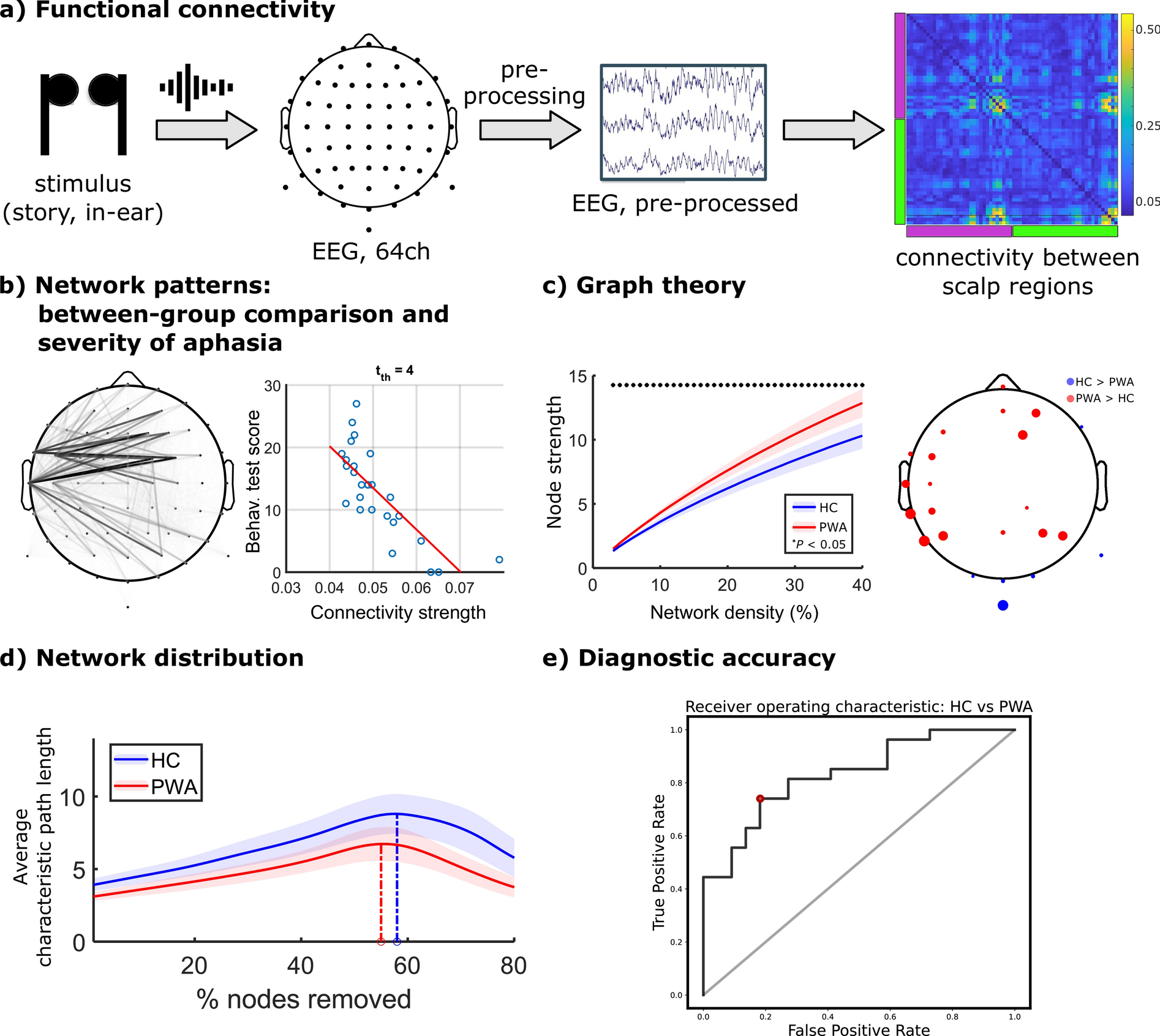 EEG reveals brain network alterations in chronic aphasia during natural speech listening