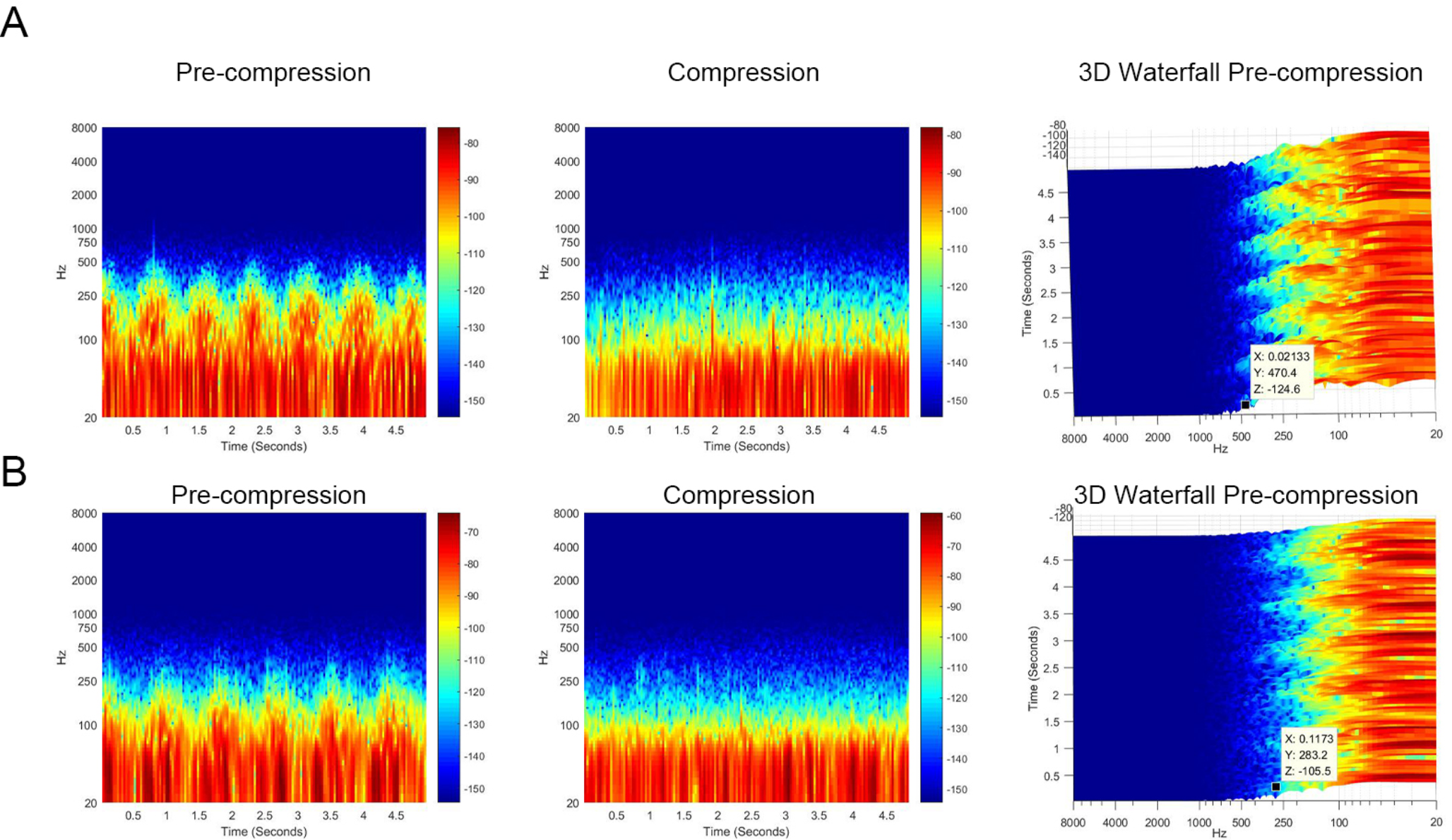 Spontaneous otoacoustic emission as a novel method to screen pulsatile tinnitus caused by sigmoid sinus wall abnormalities: a prospective study