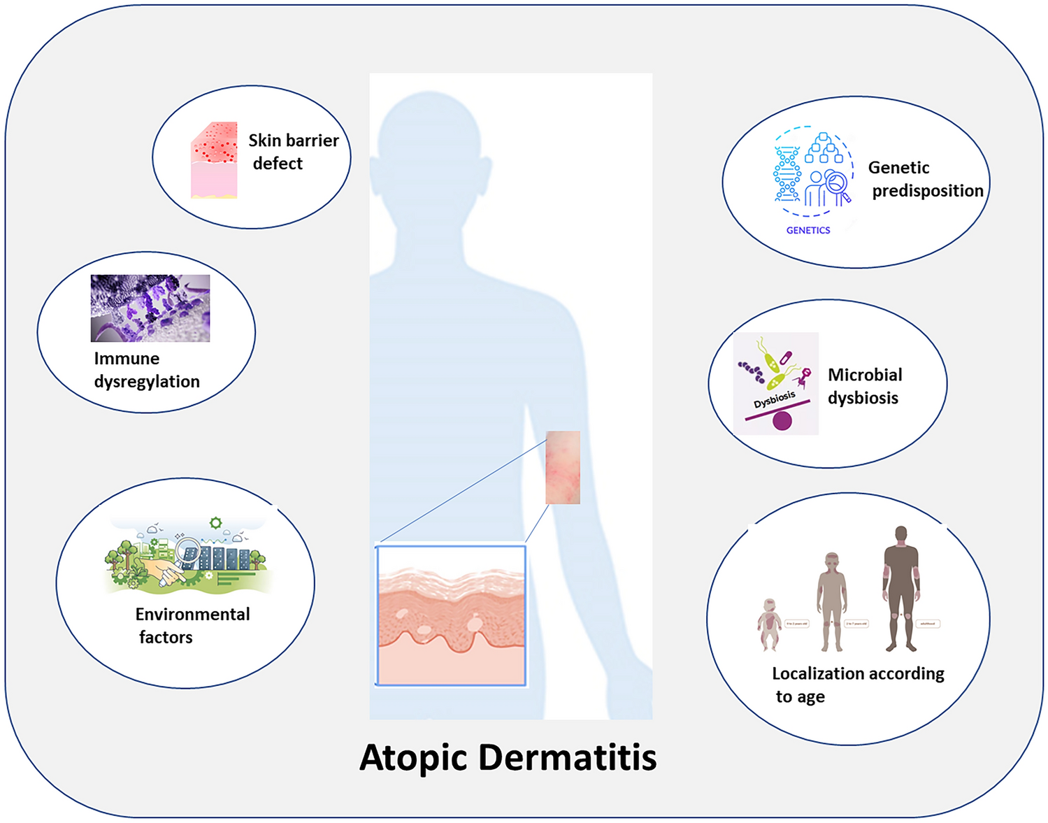 Atopic dermatitis: a comprehensive updated review of this intriguing disease with futuristic insights