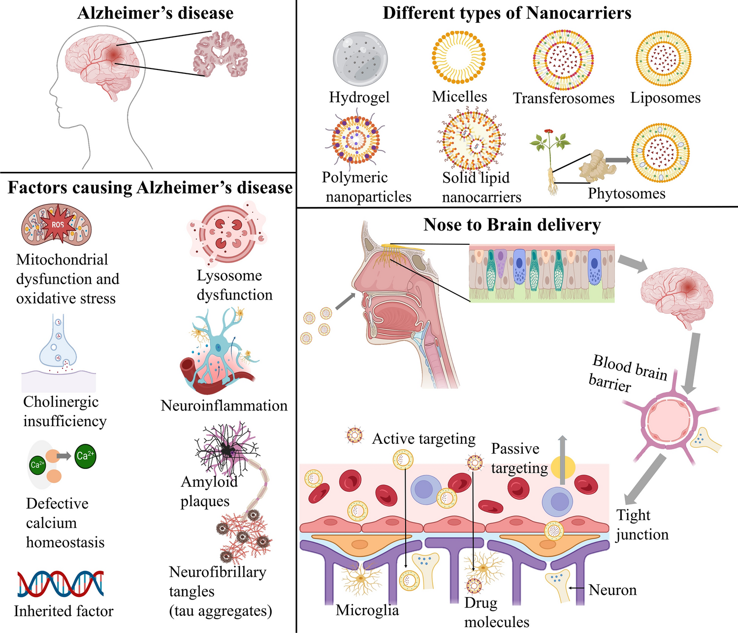 Advancements in nose-to-brain drug targeting for Alzheimer’s disease: a review of nanocarriers and clinical insights