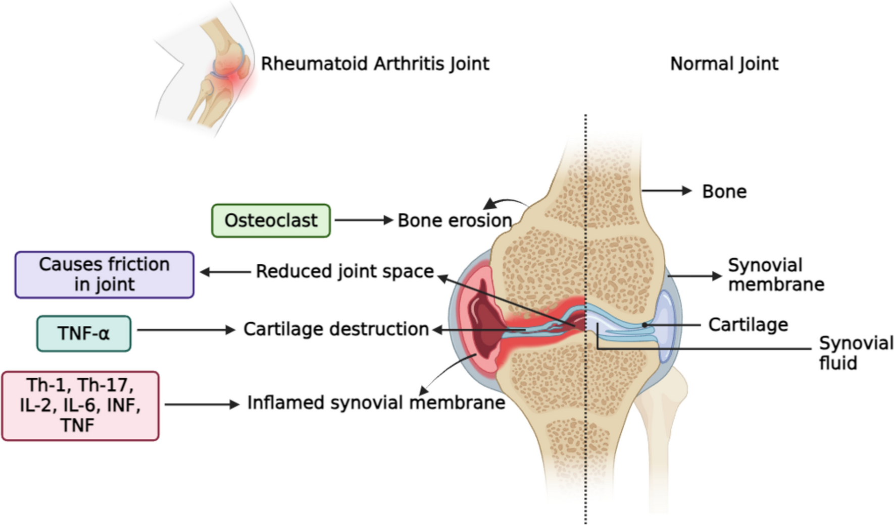 Unraveling the hormonal approaches for the treatment of rheumatoid arthritis and its complementary interventions