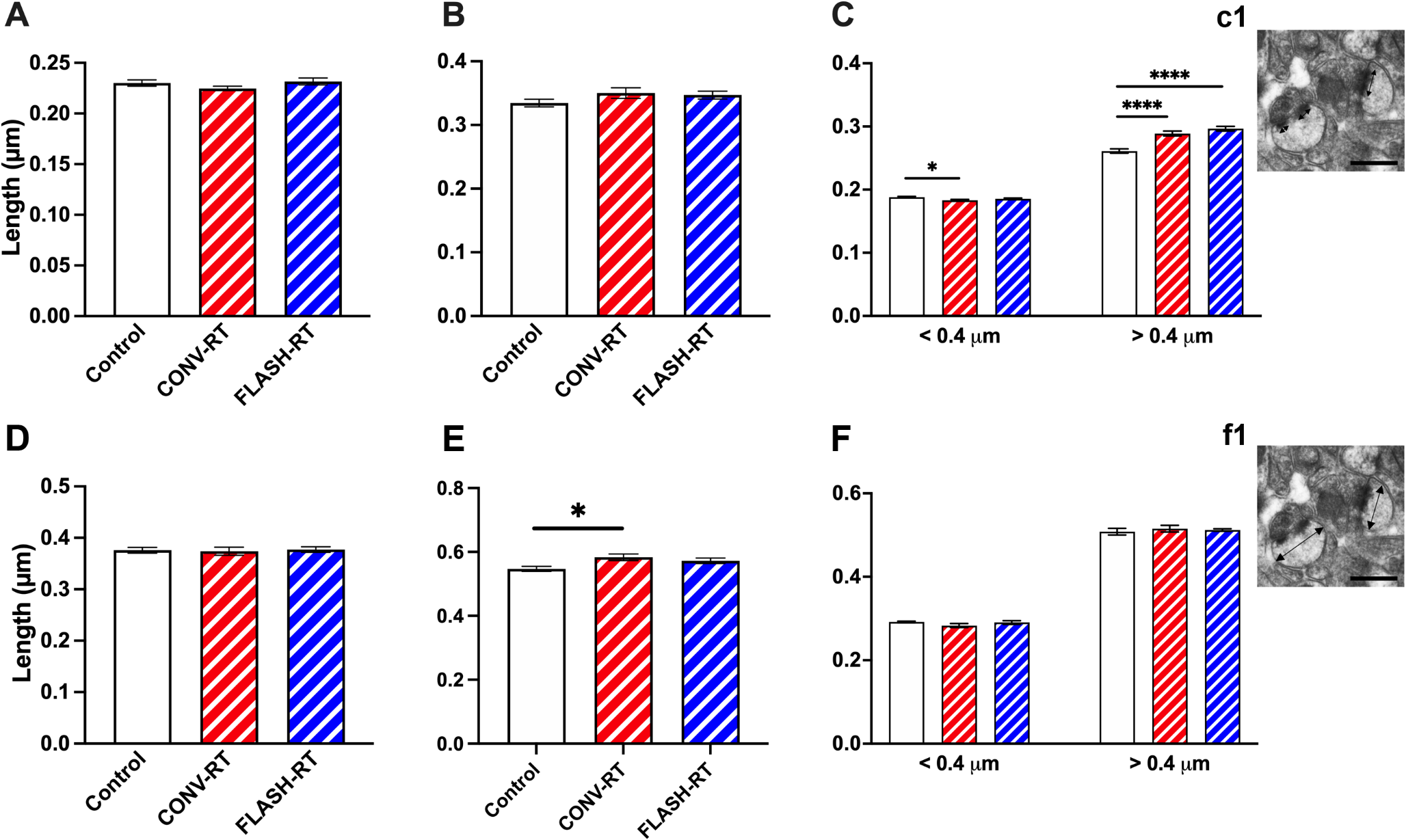 Structural plasticity of pyramidal cell neurons measured after FLASH and conventional dose-rate irradiation