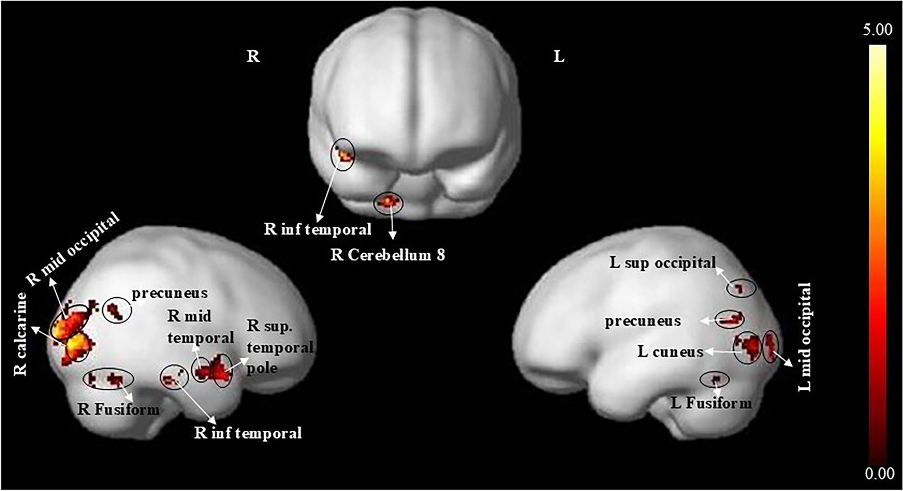 Neural correlates of auditory comprehension and integration of sanskrit verse: a functional MRI study